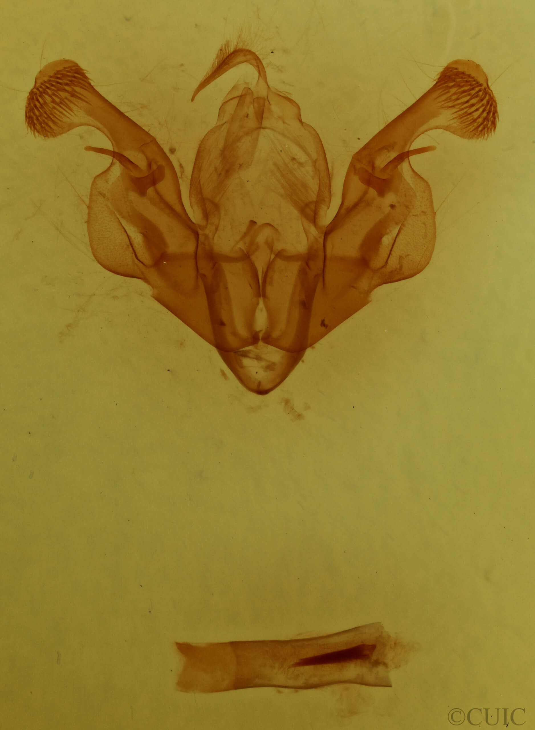 genitalia view of adult Mythimna l-album