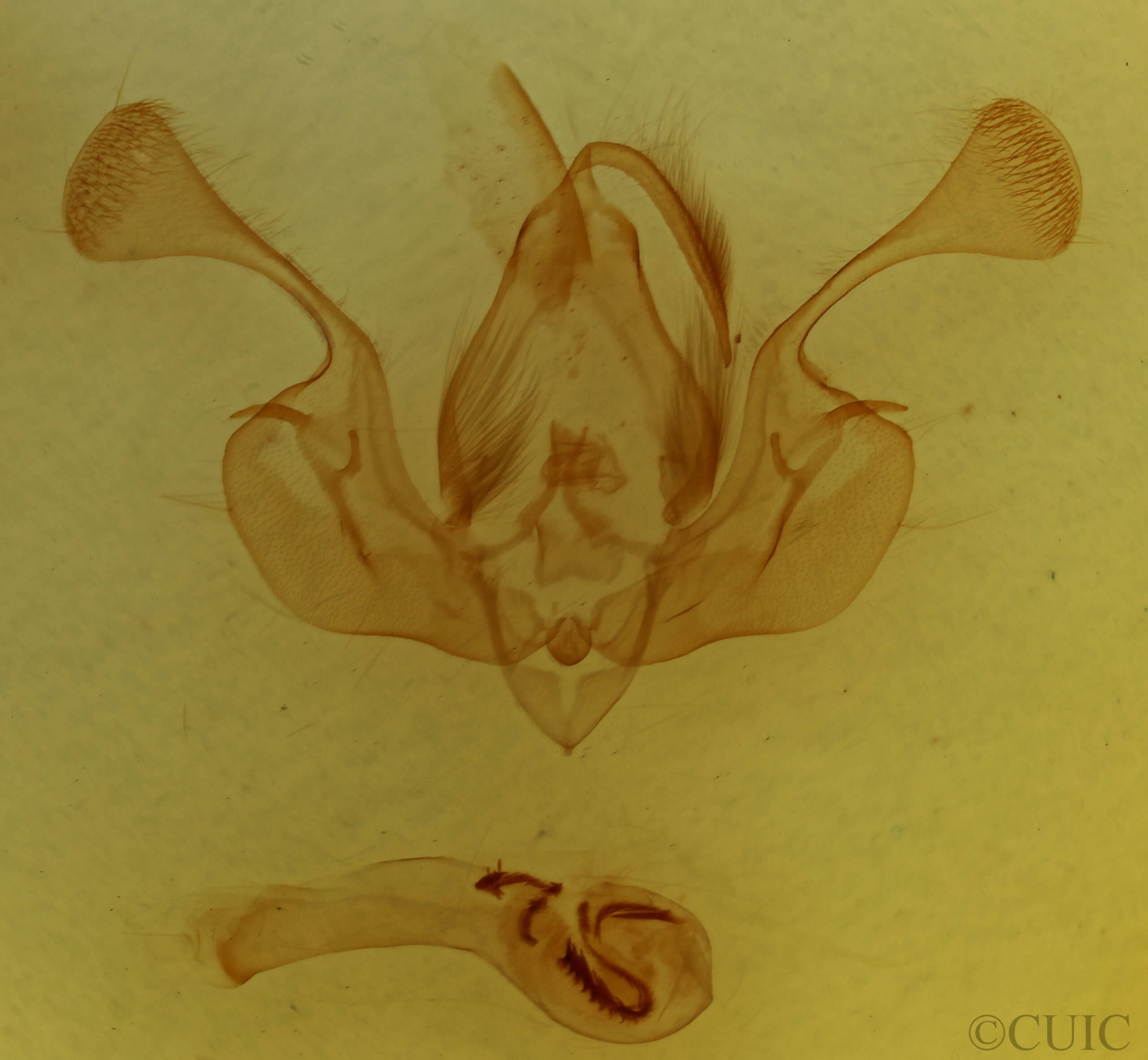 genitalia view of adult Mythimna pudorina