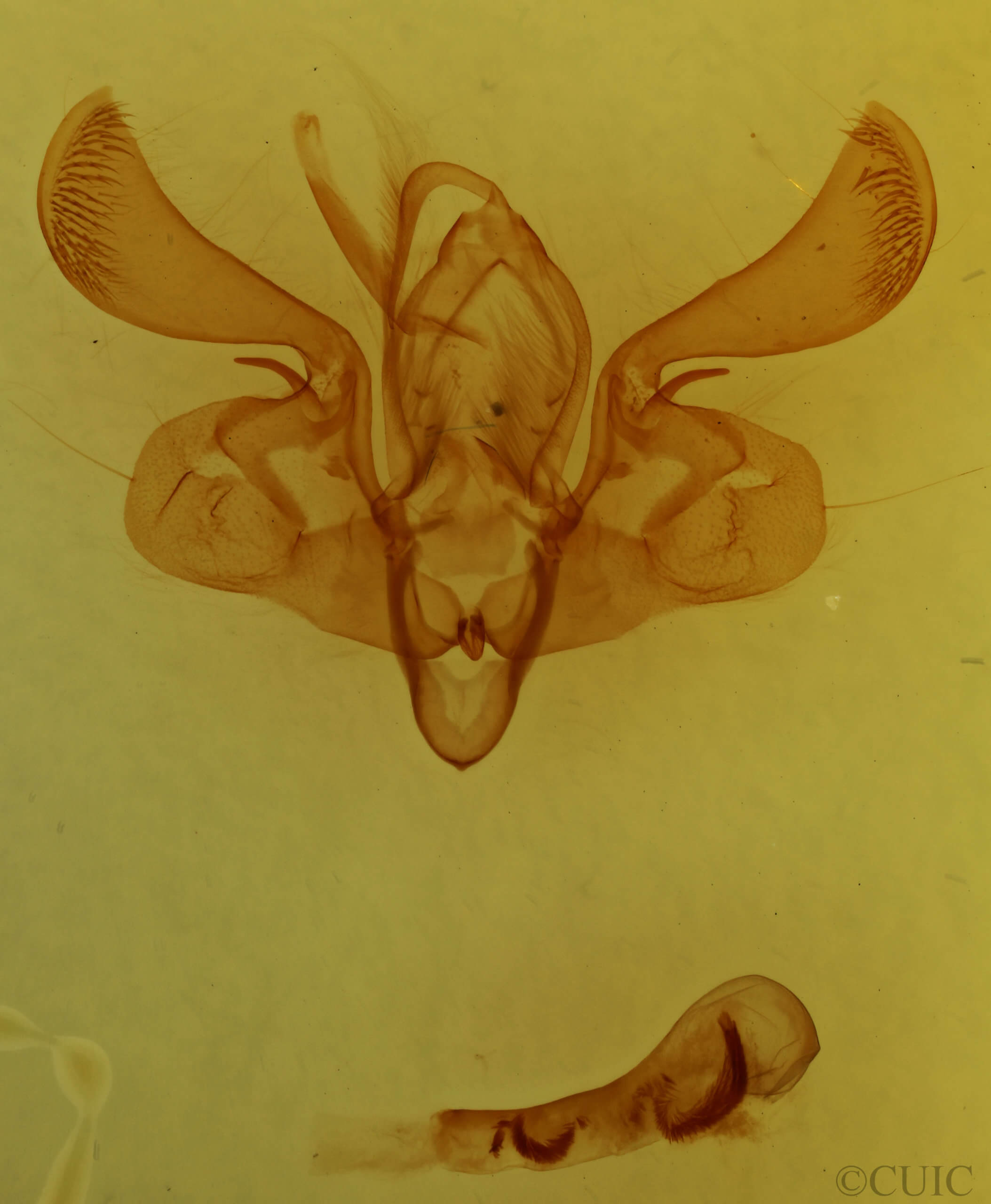 genitalia view of adult Mythimna straminea