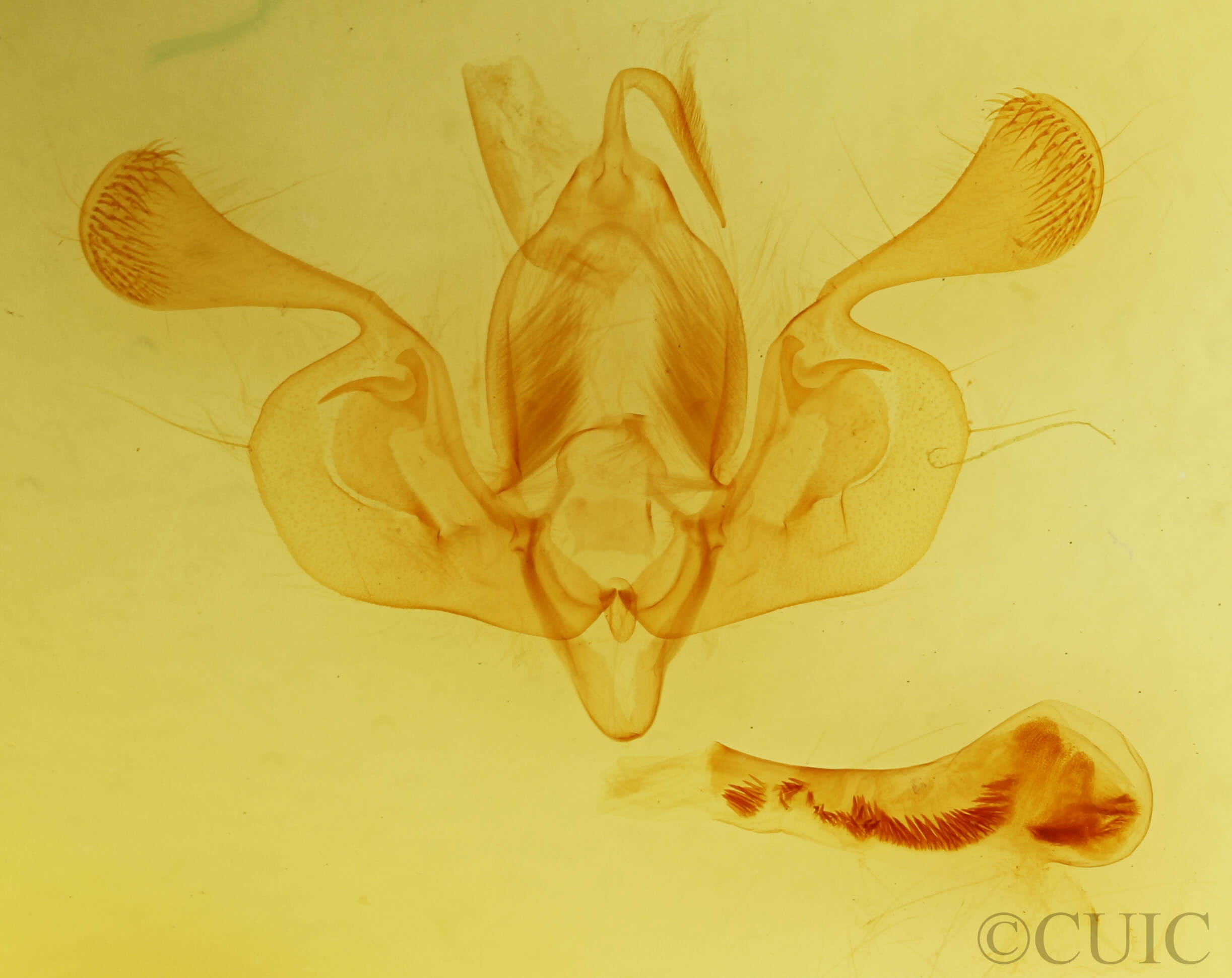 genitalia view of adult Mythimna vitellina