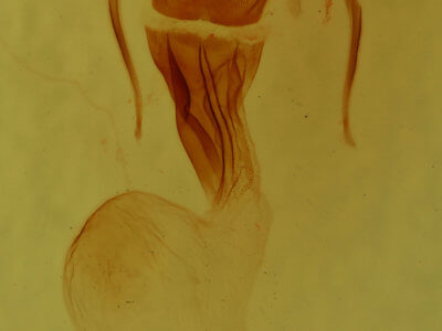 genitalia view of adult Loscopia velata