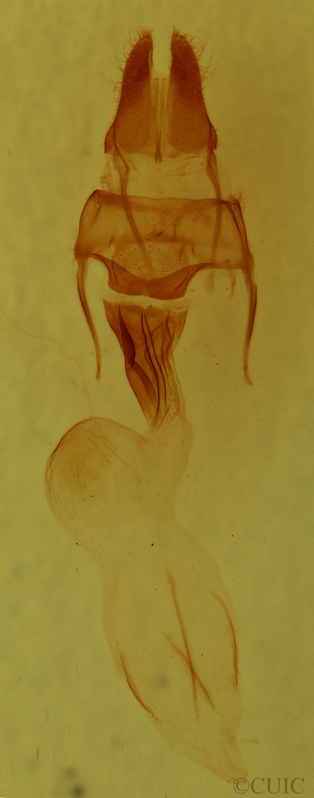 genitalia view of adult Loscopia velata