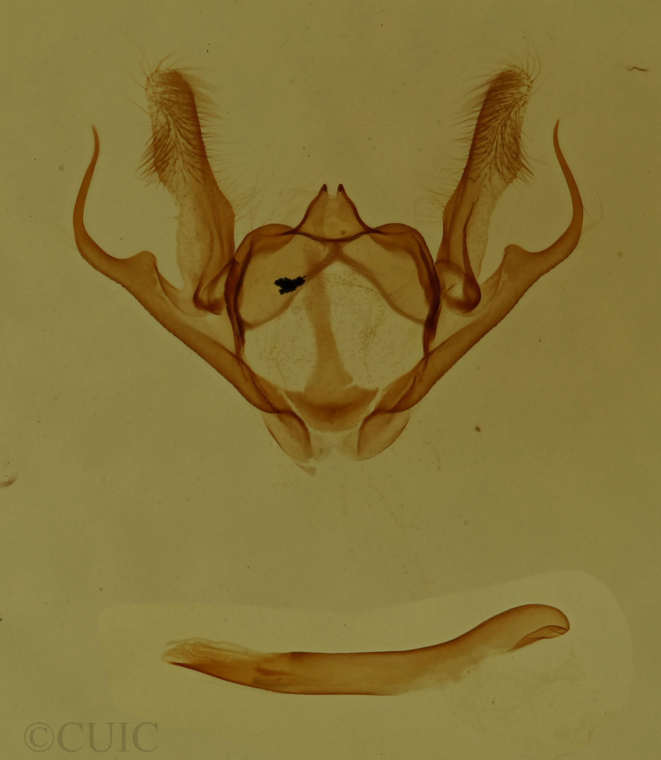 genitalia view of adult Anacamptodes
