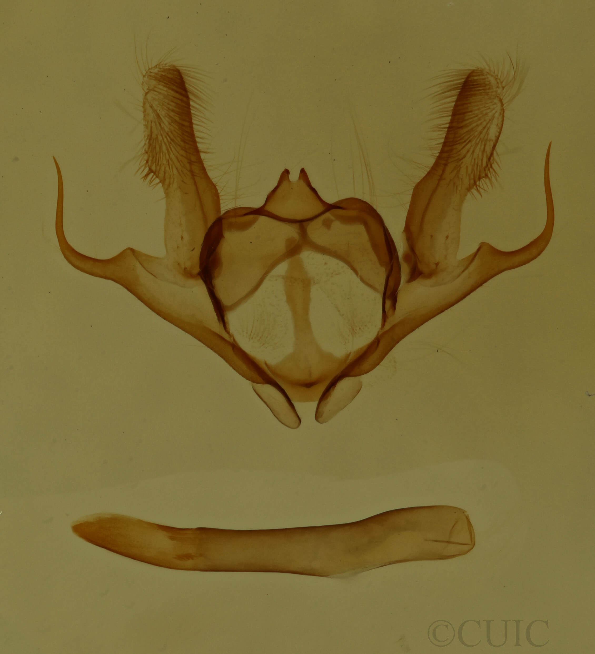 genitalia view of adult Anacamptodes