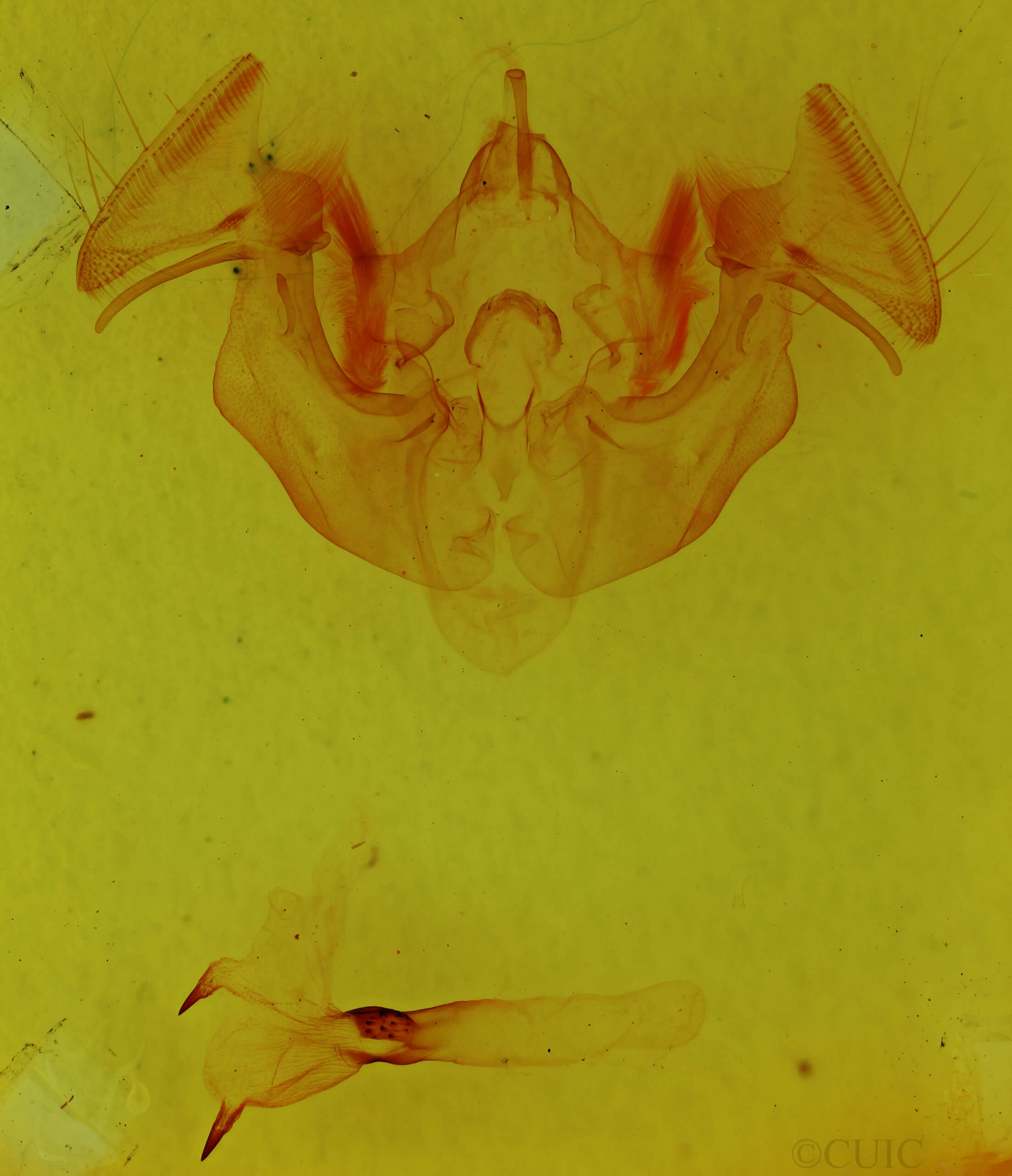 genitalia view of adult Apamea dubitans