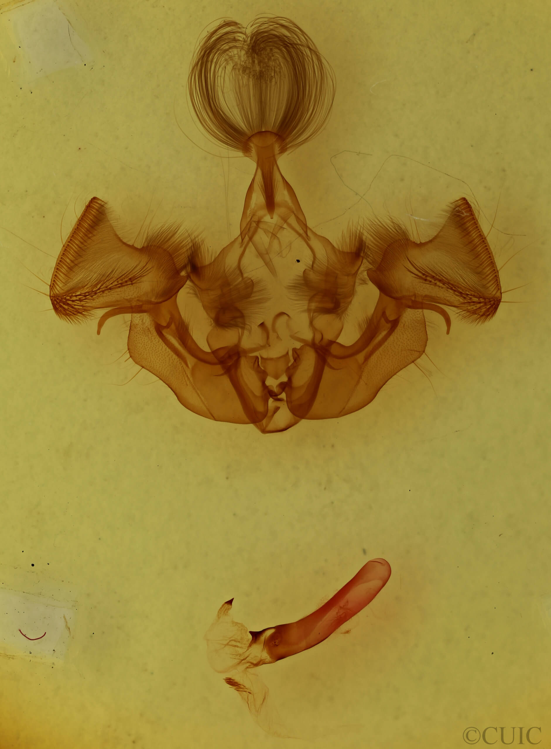 genitalia view of adult Apamea vulgaris