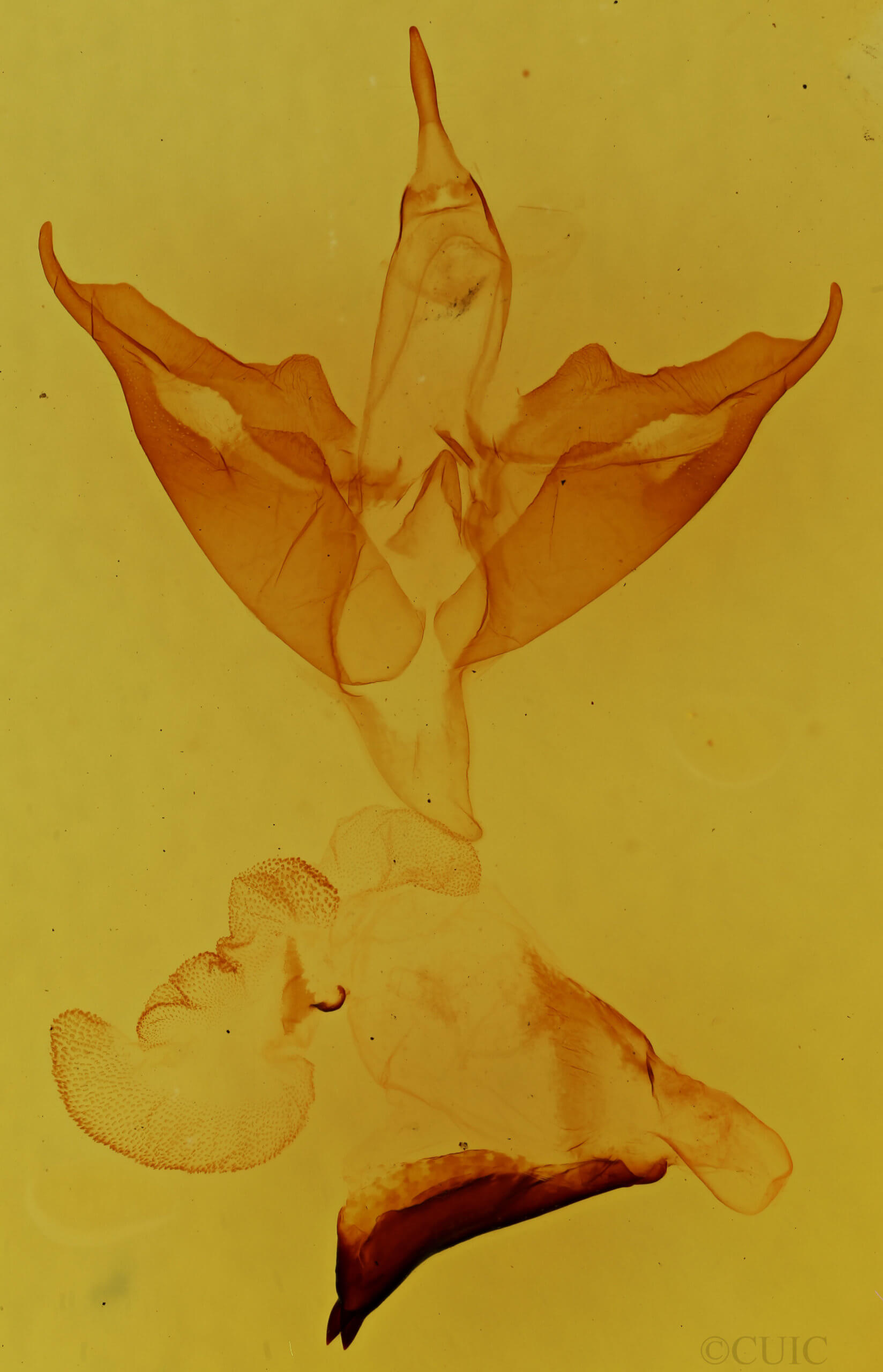 genitalia view of adult Apantesis phalerata