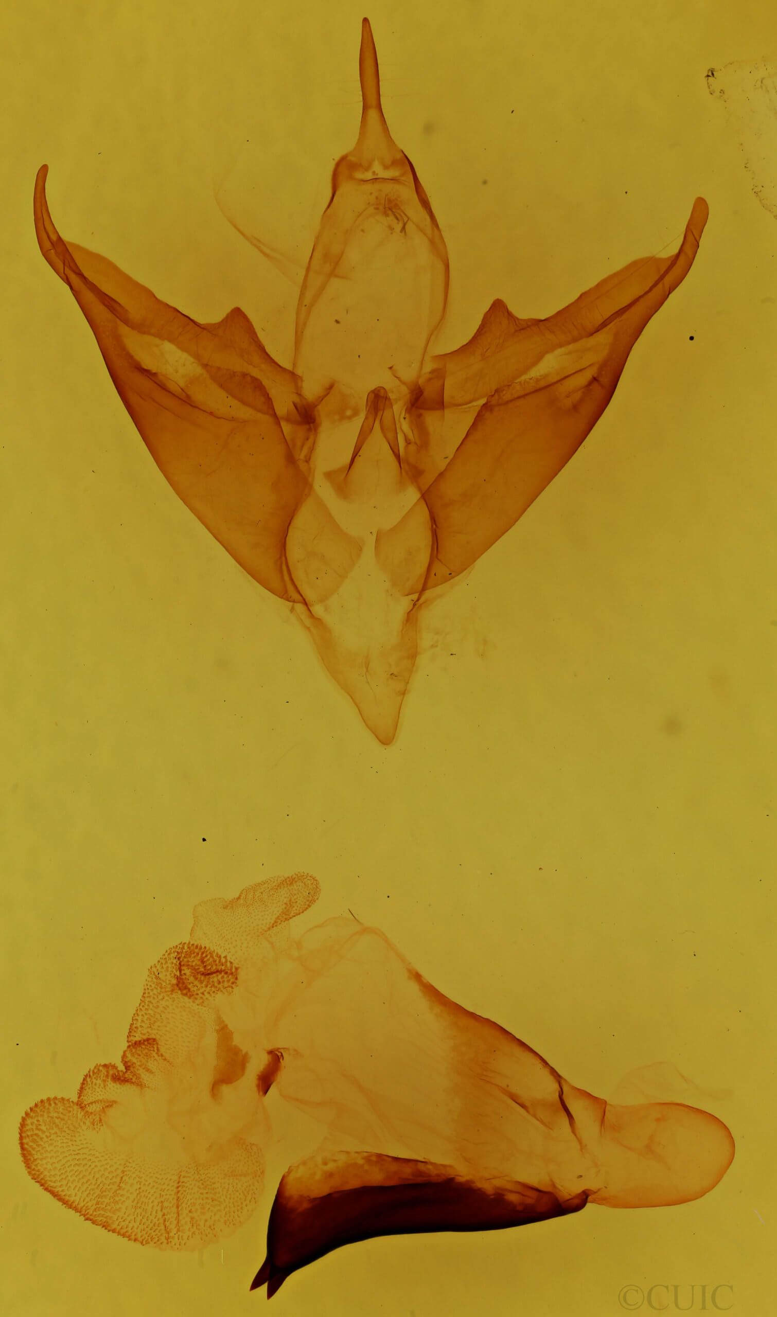 genitalia view of adult Apantesis phalerata