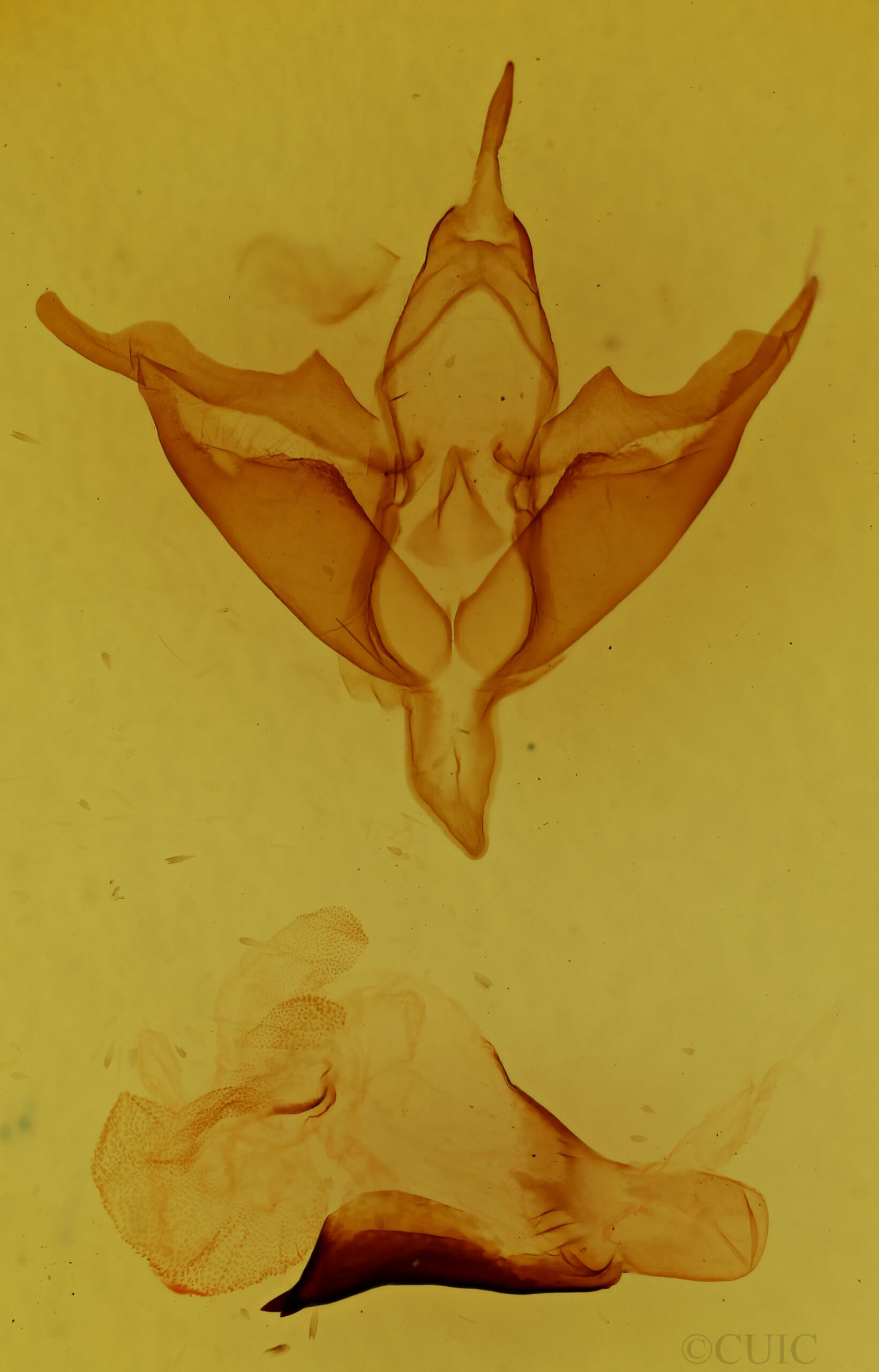 genitalia view of adult Apantesis phalerata