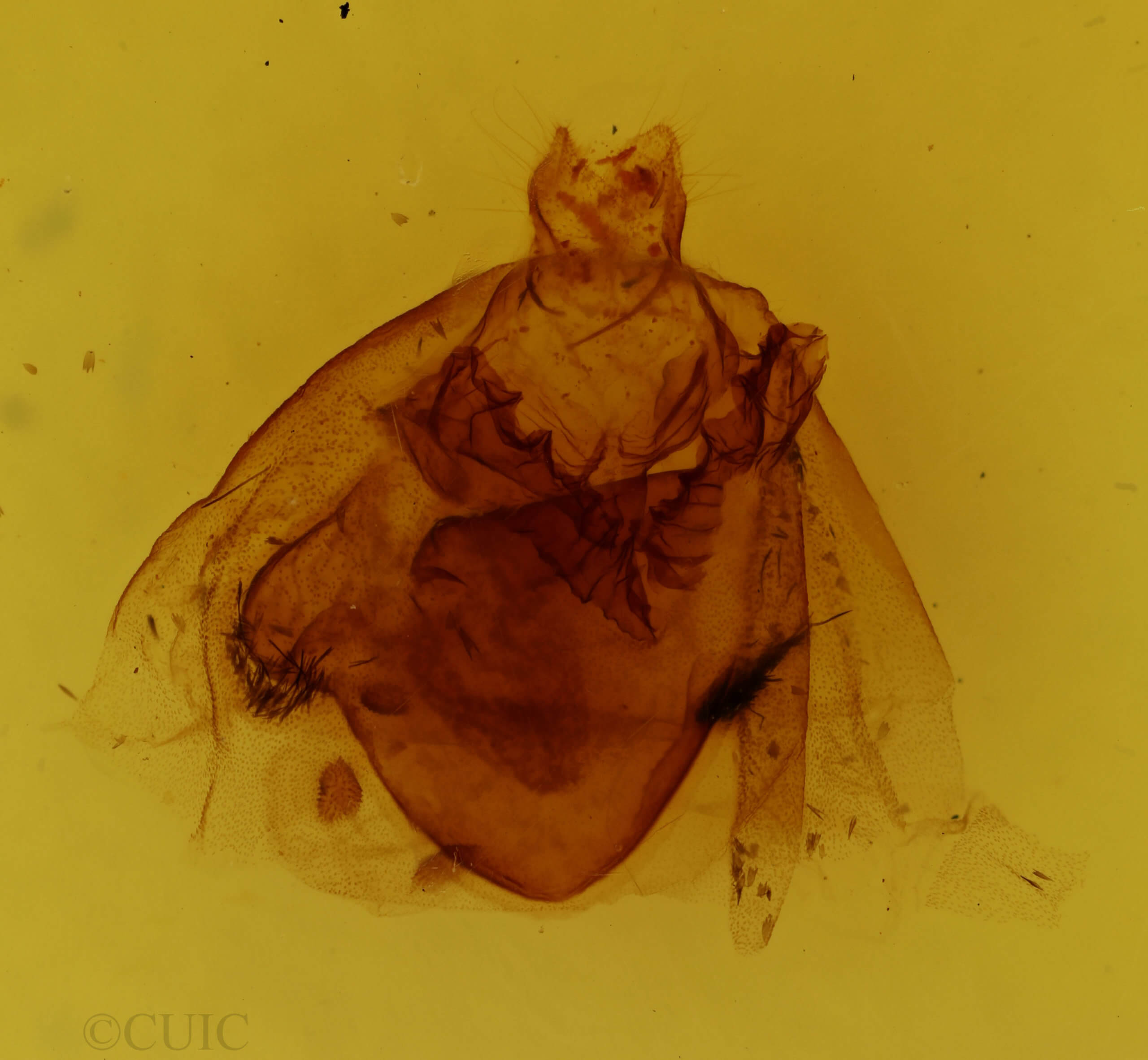 genitalia view of adult Apantesis phalerata