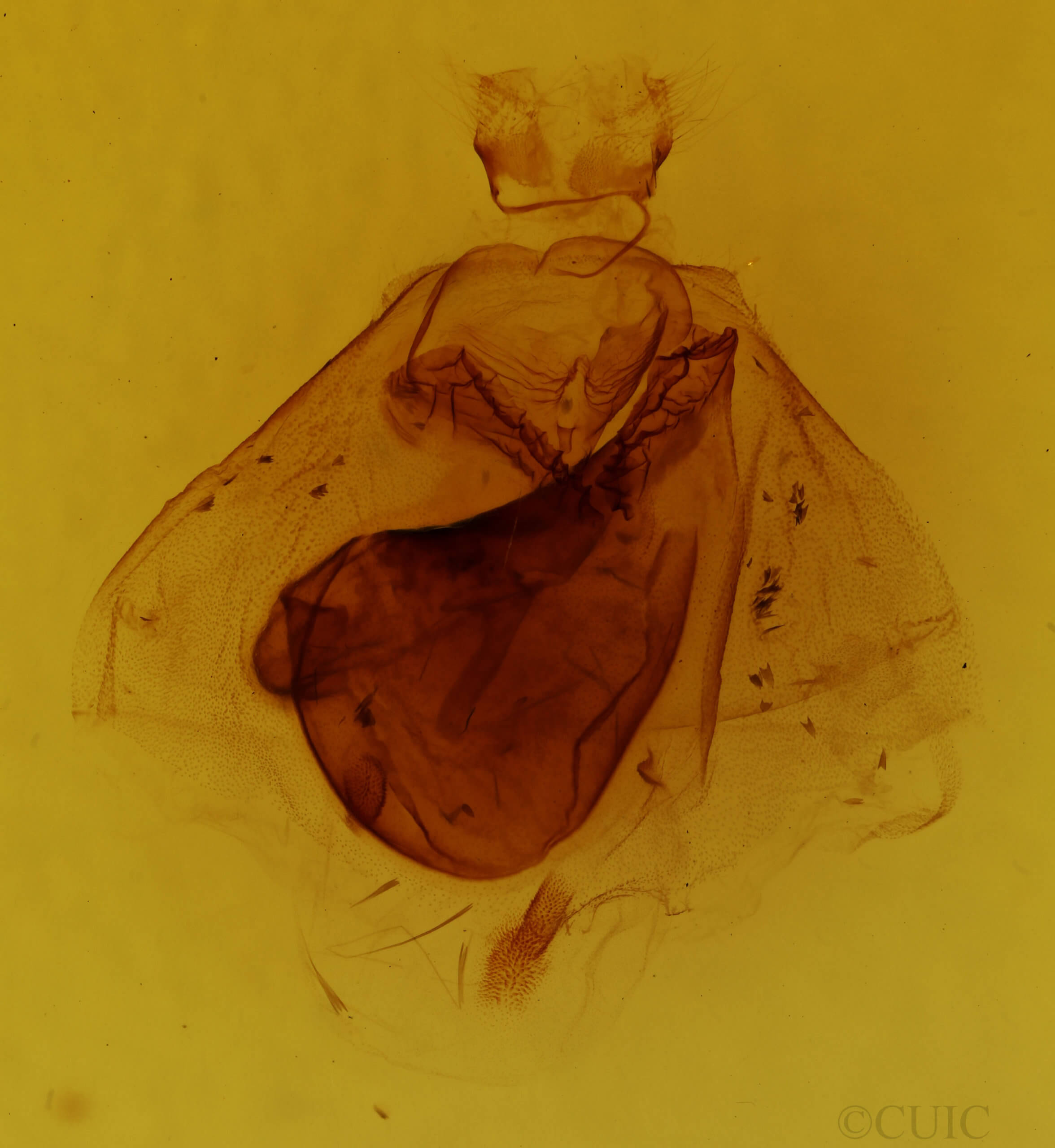 genitalia view of adult Apantesis phalerata