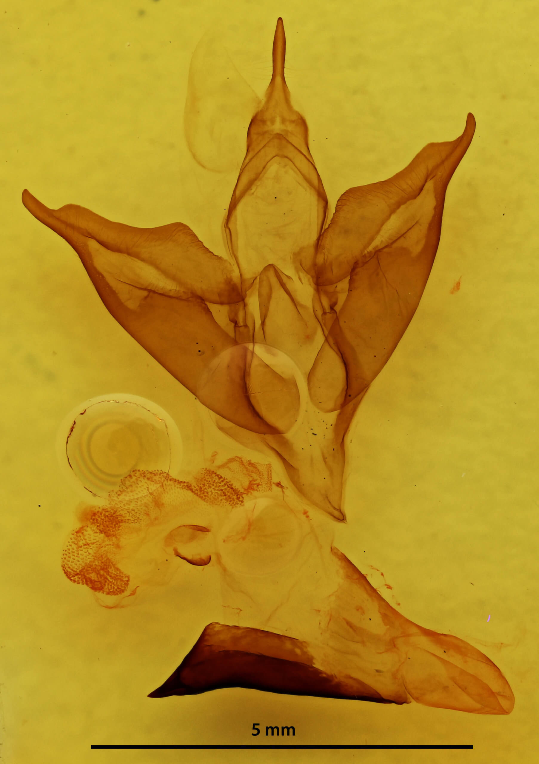 genitalia view of adult Apantesis phalerata
