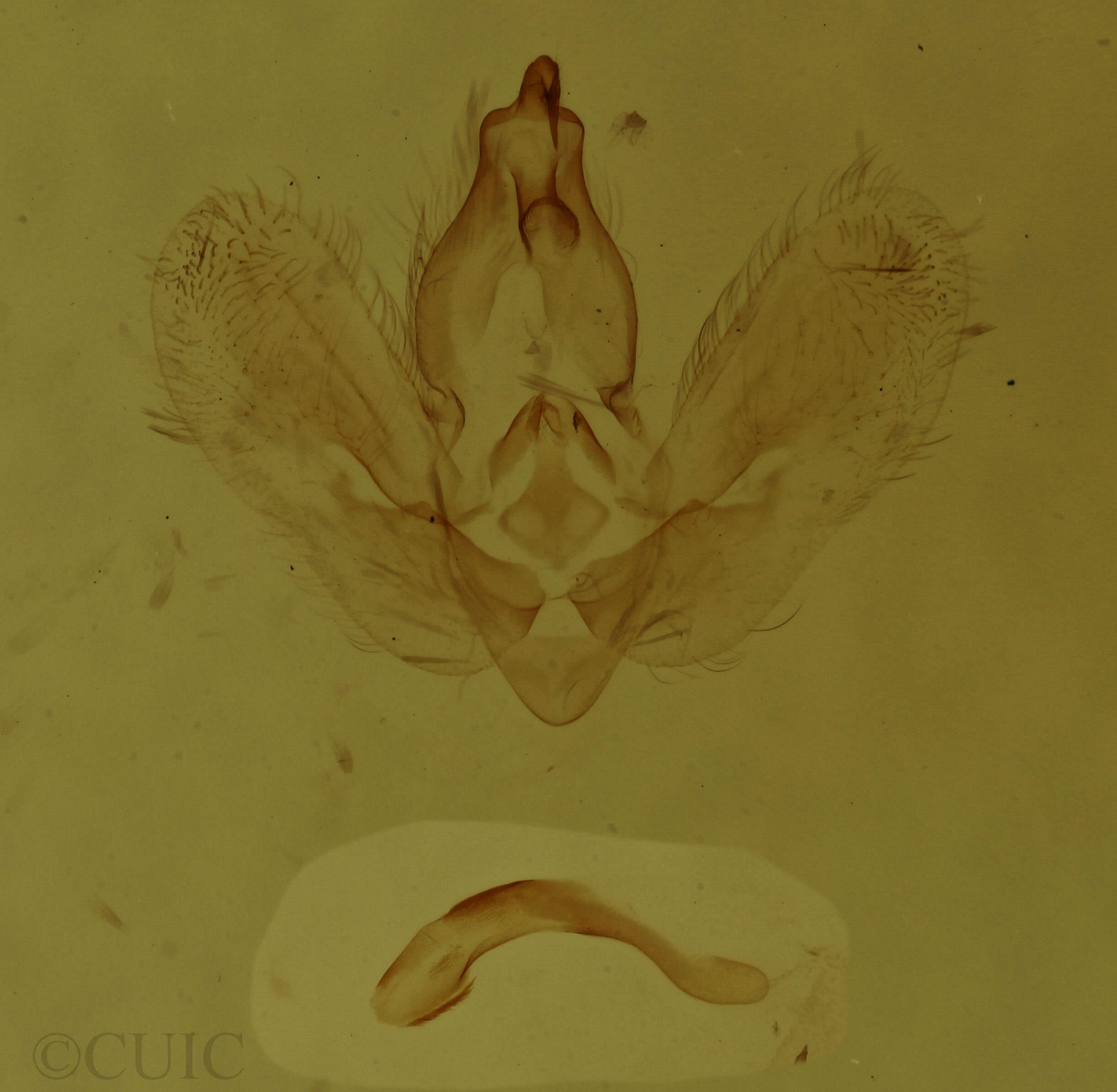 genitalia view of adult Hypena baltimoralis
