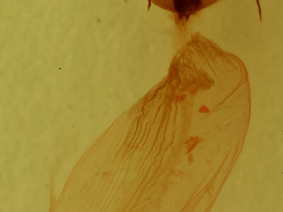 genitalia view of adult Condica confederata