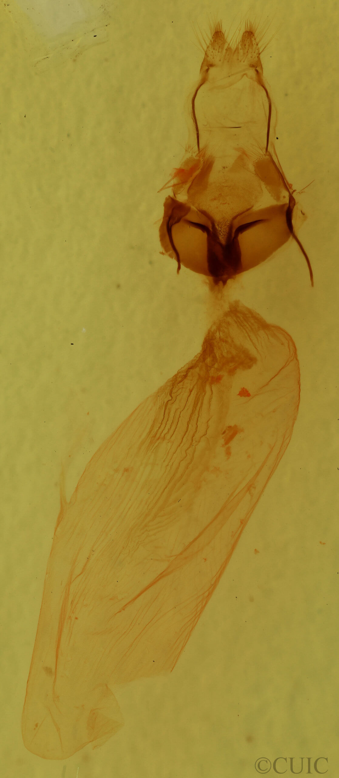 genitalia view of adult Condica confederata