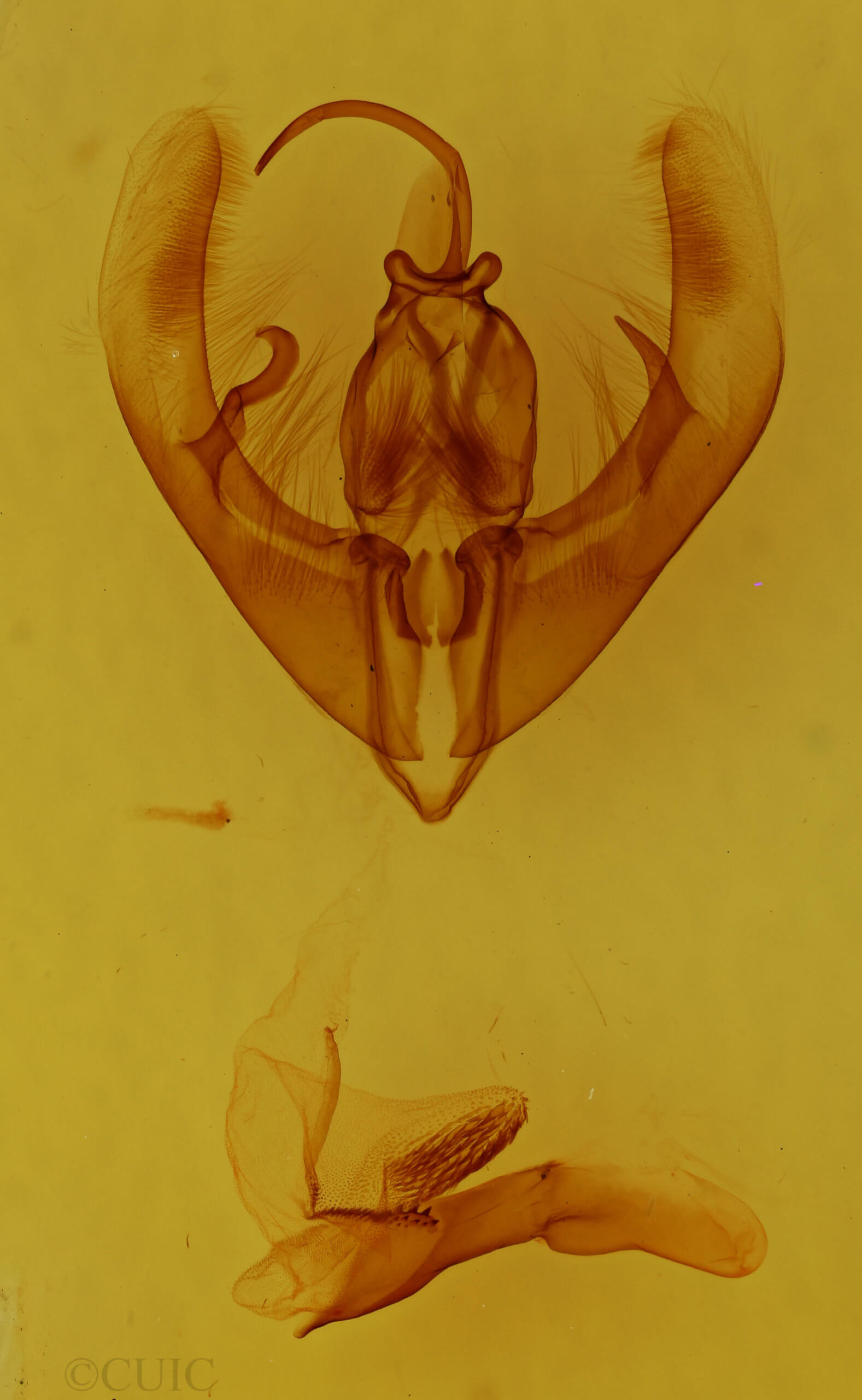 genitalia view of adult Condica confederata