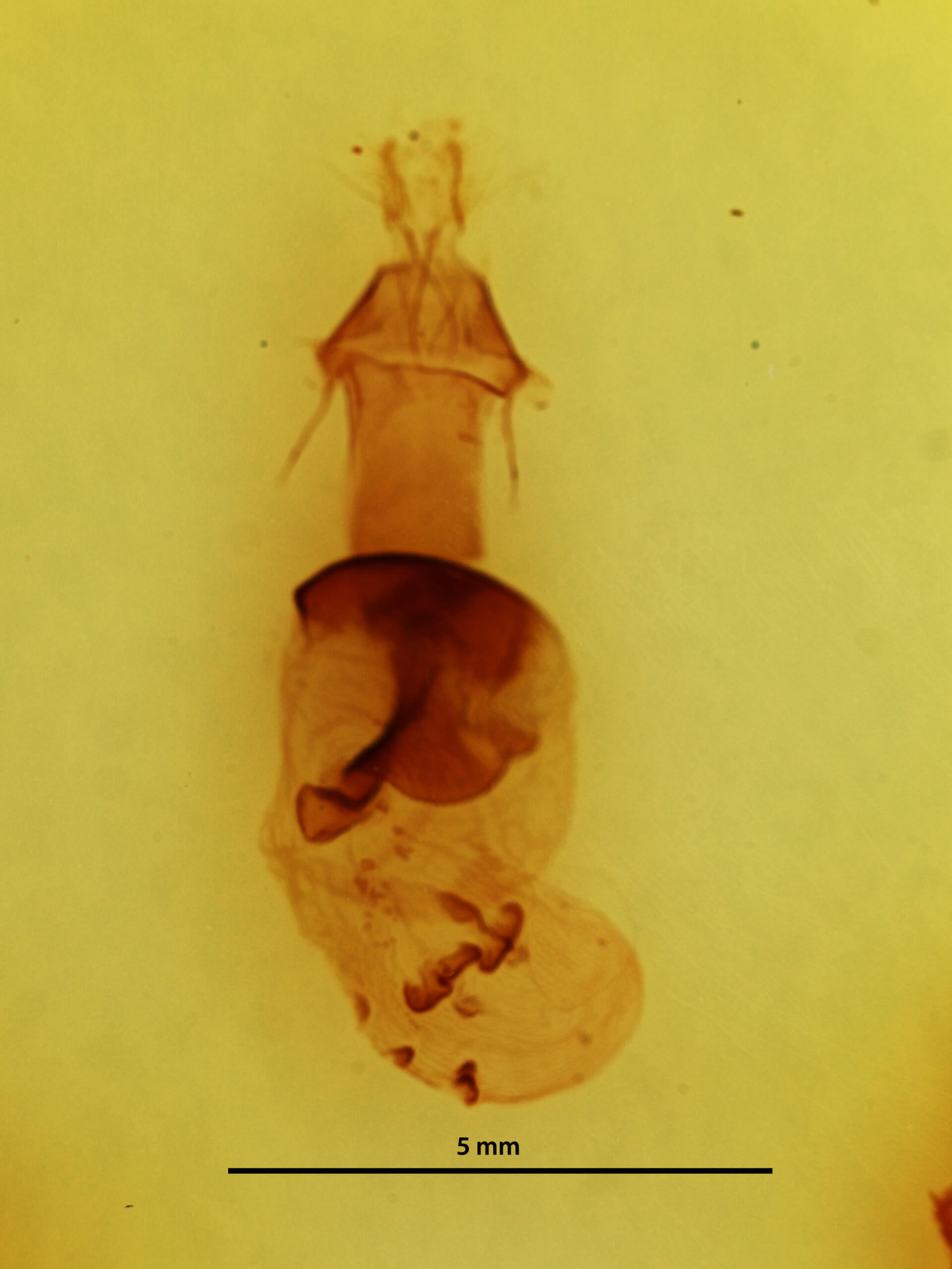 genitalia view of adult Conistra ardescens