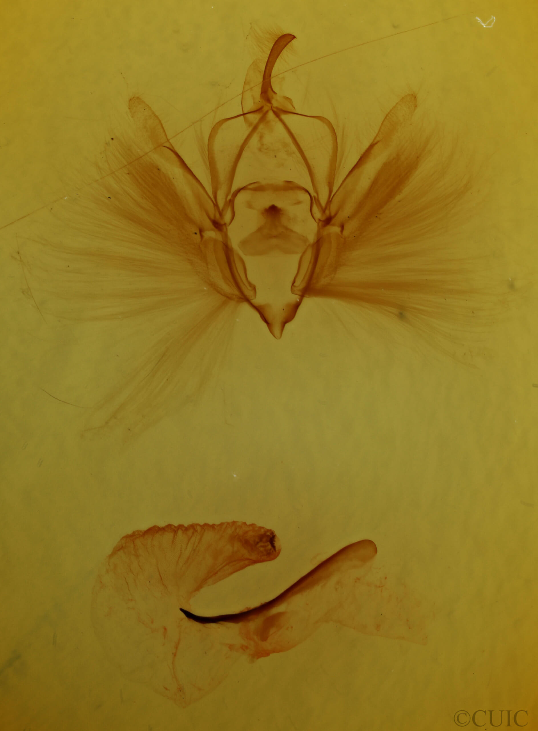 genitalia view of adult Dipterygina japonica