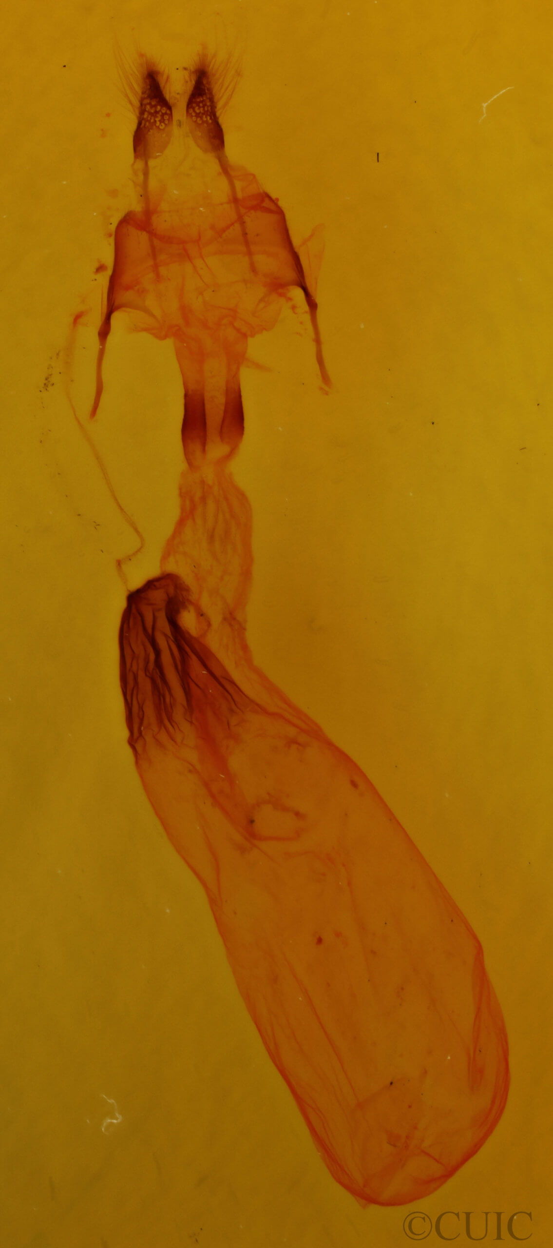 genitalia view of adult Dipterygina japonica