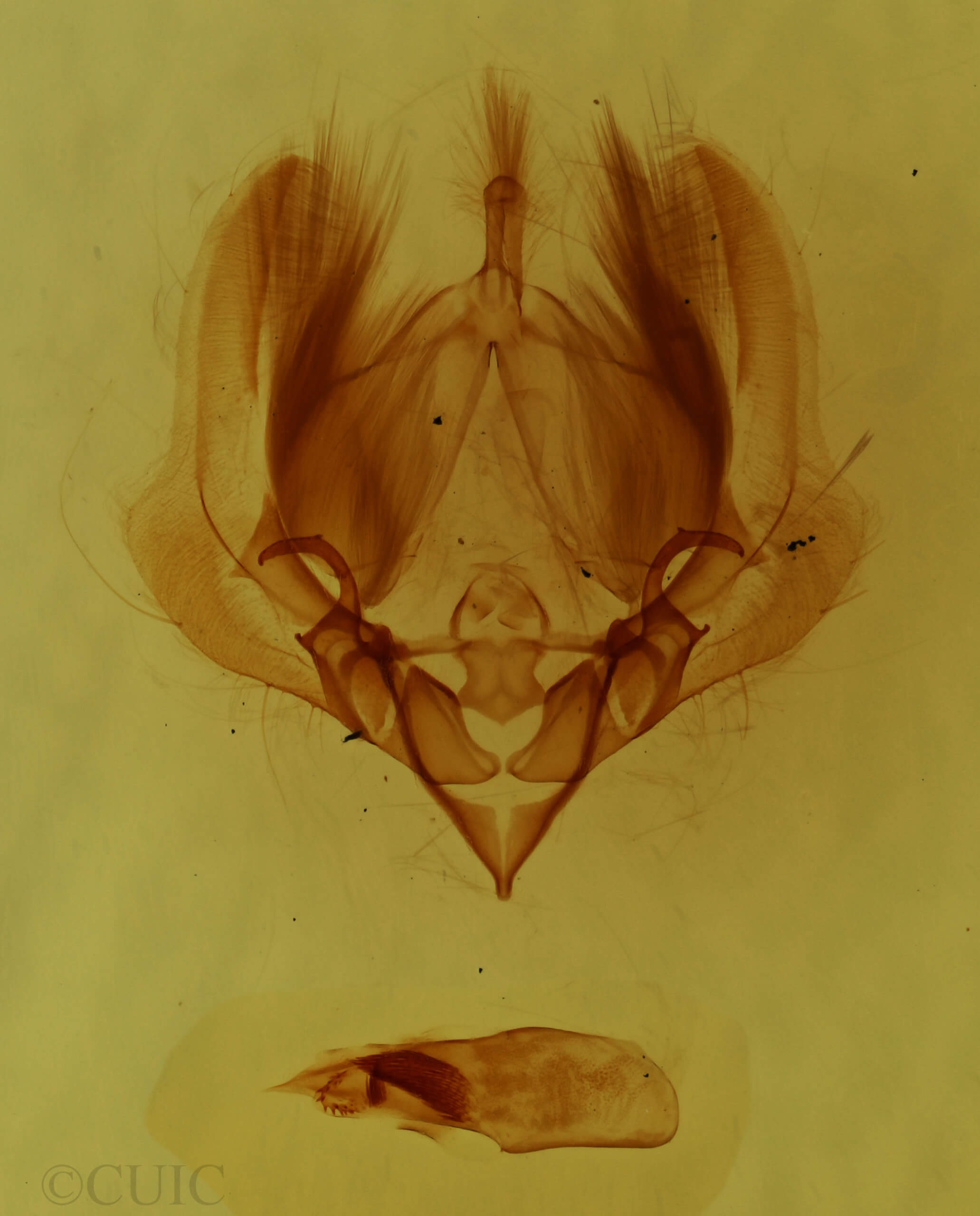 genitalia view of adult Elaphria chalcedonia