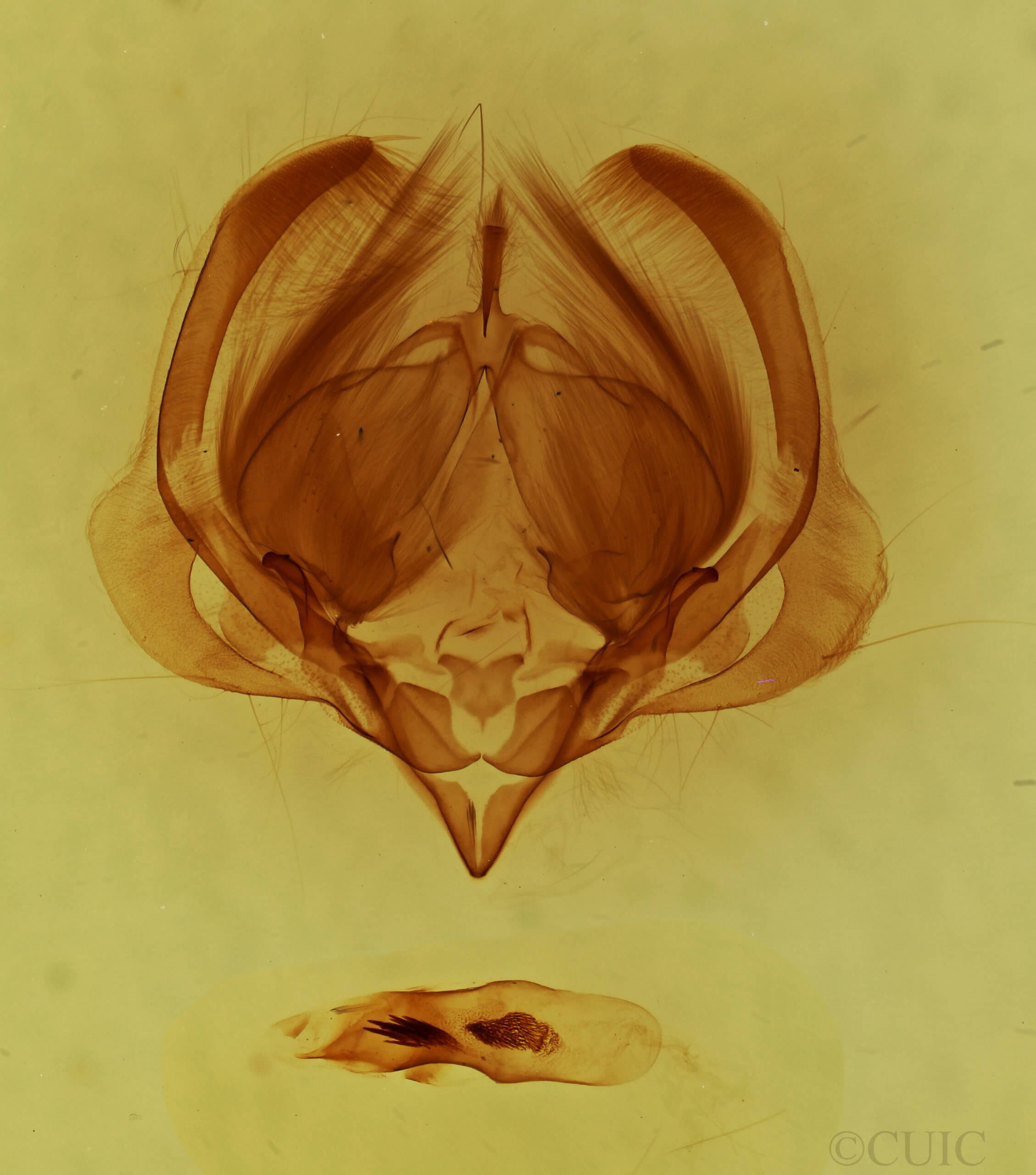 genitalia view of adult Elaphria exesa