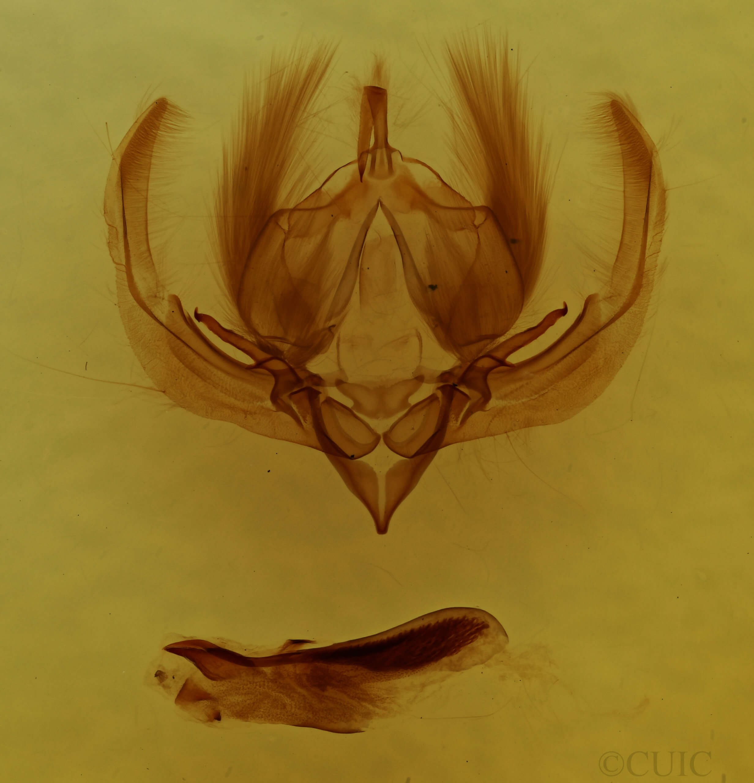 genitalia view of adult Elaphria fuscimacula