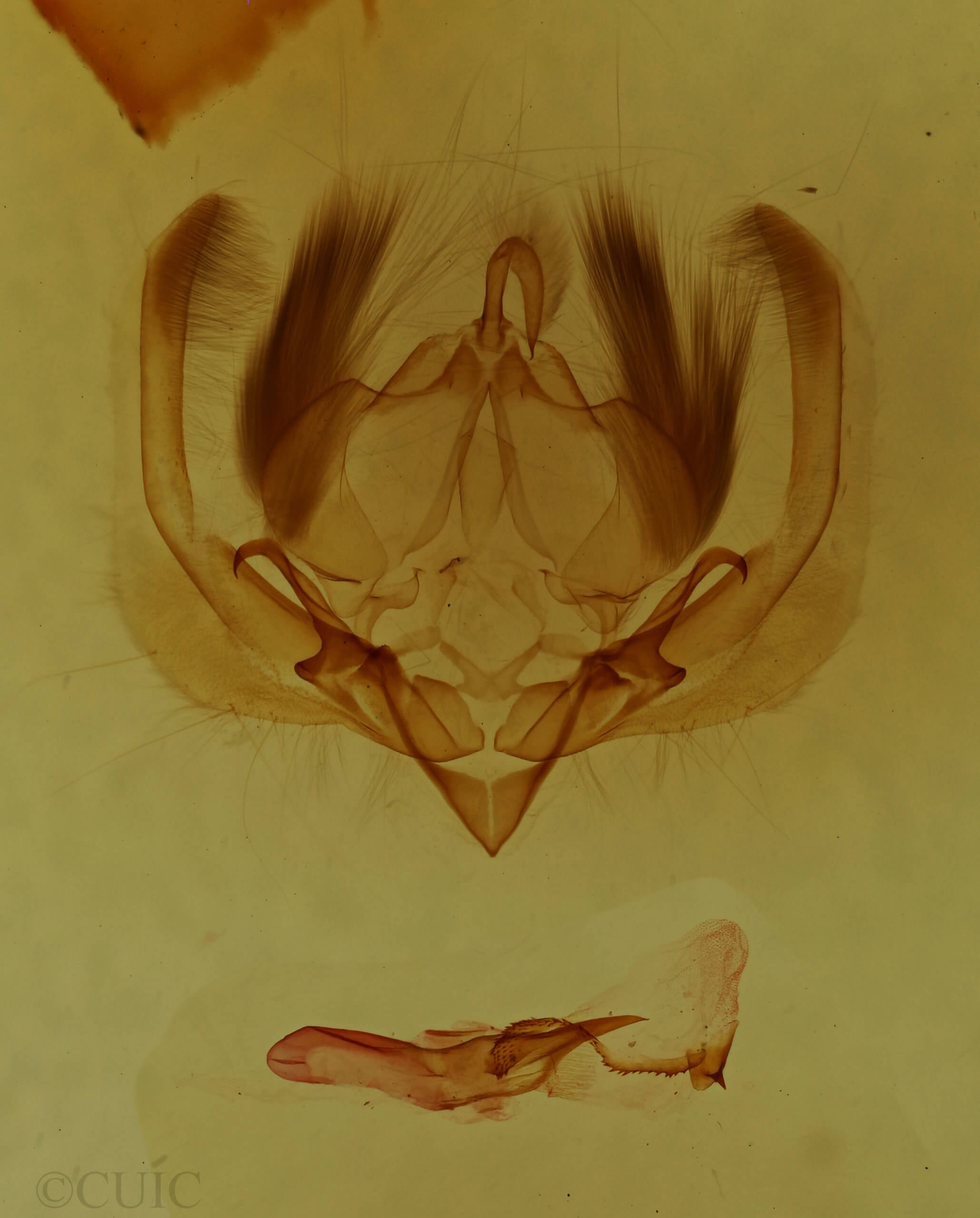genitalia view of adult Elaphria grata