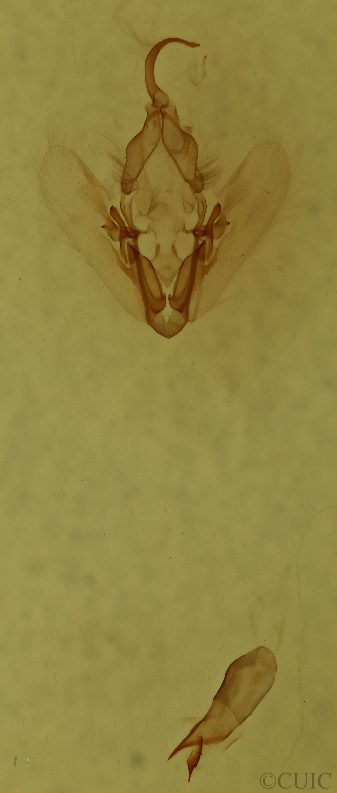 genitalia view of adult Elaphria versicolor