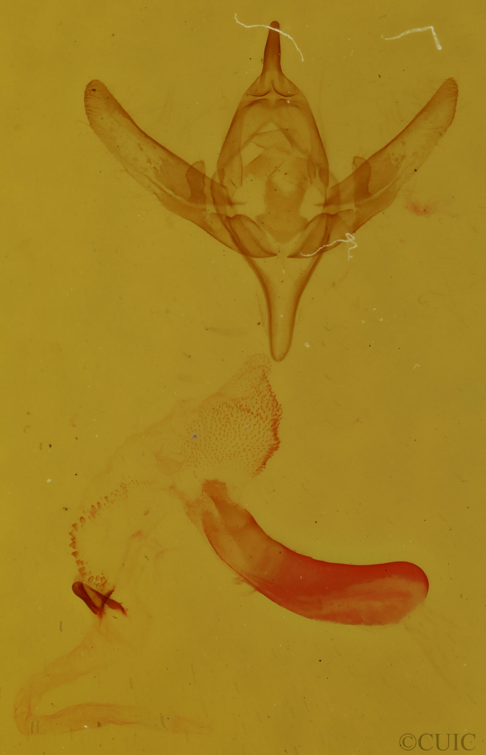 genitalia view of adult Emariannia cucullidea
