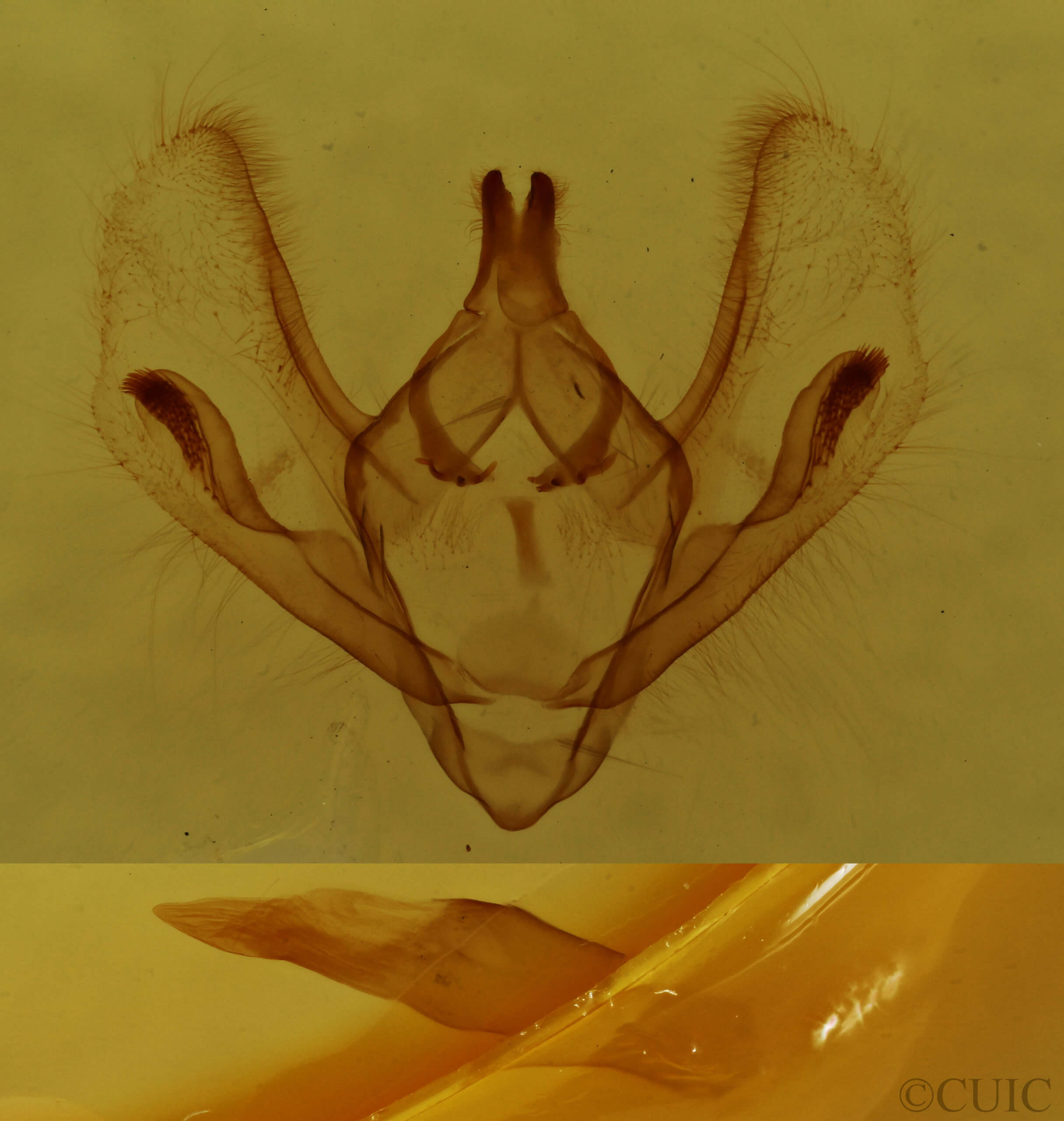 genitalia view of adult Epimecis hortaria
