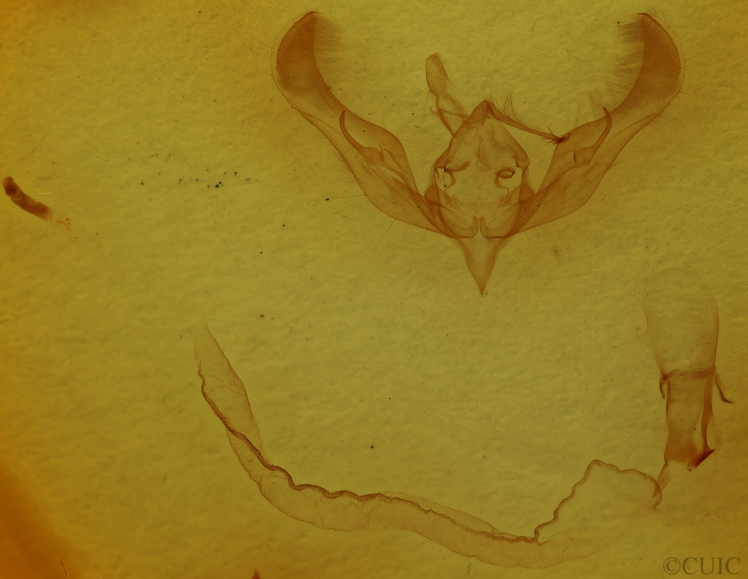 genitalia view of adult Anicla illapsa