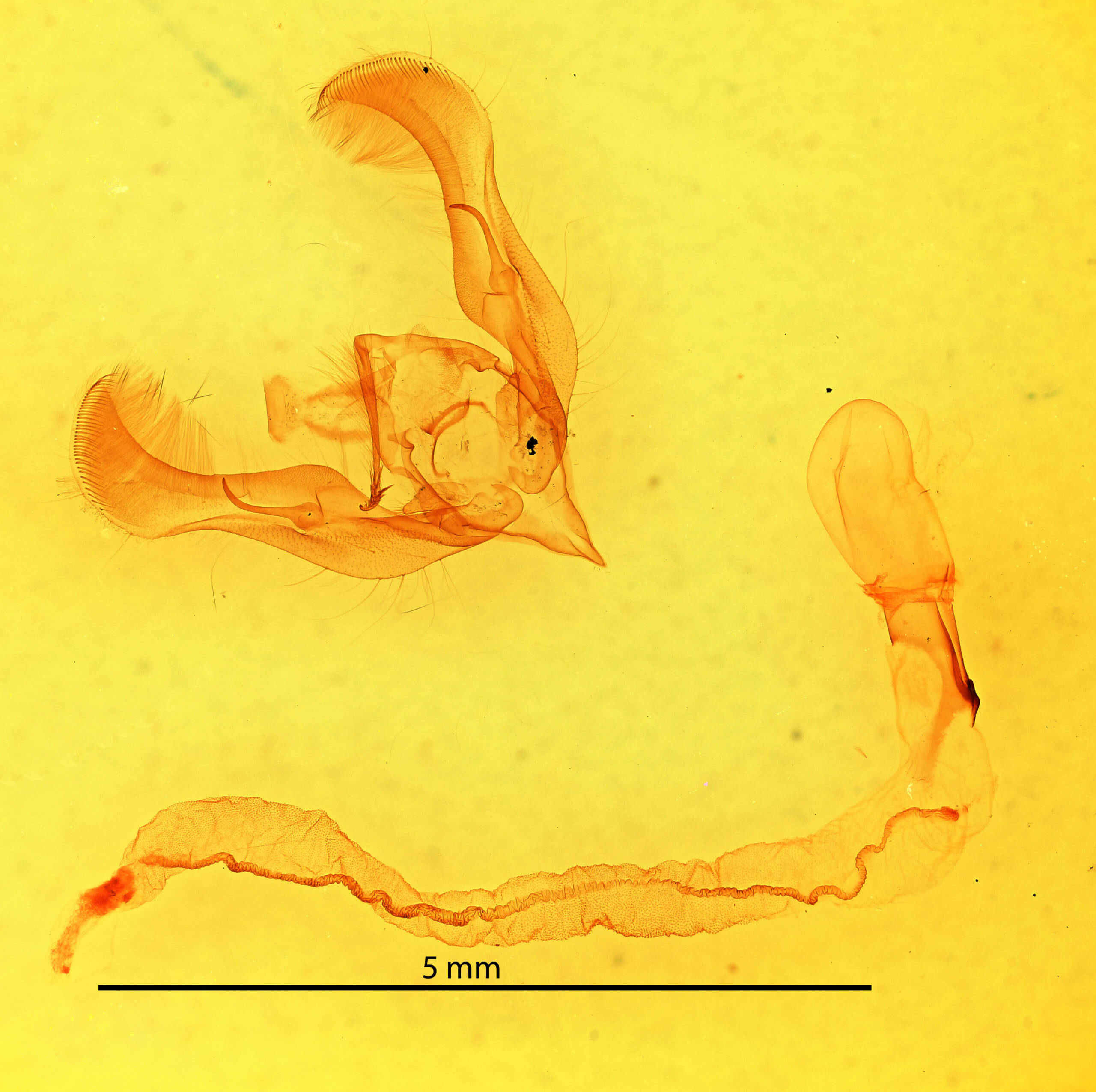 genitalia view of adult Anicla lubricans