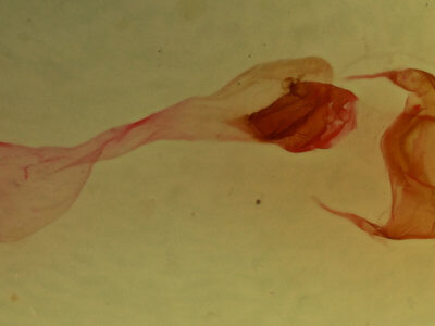 genitalia view of adult Eucirrhoedia pampina