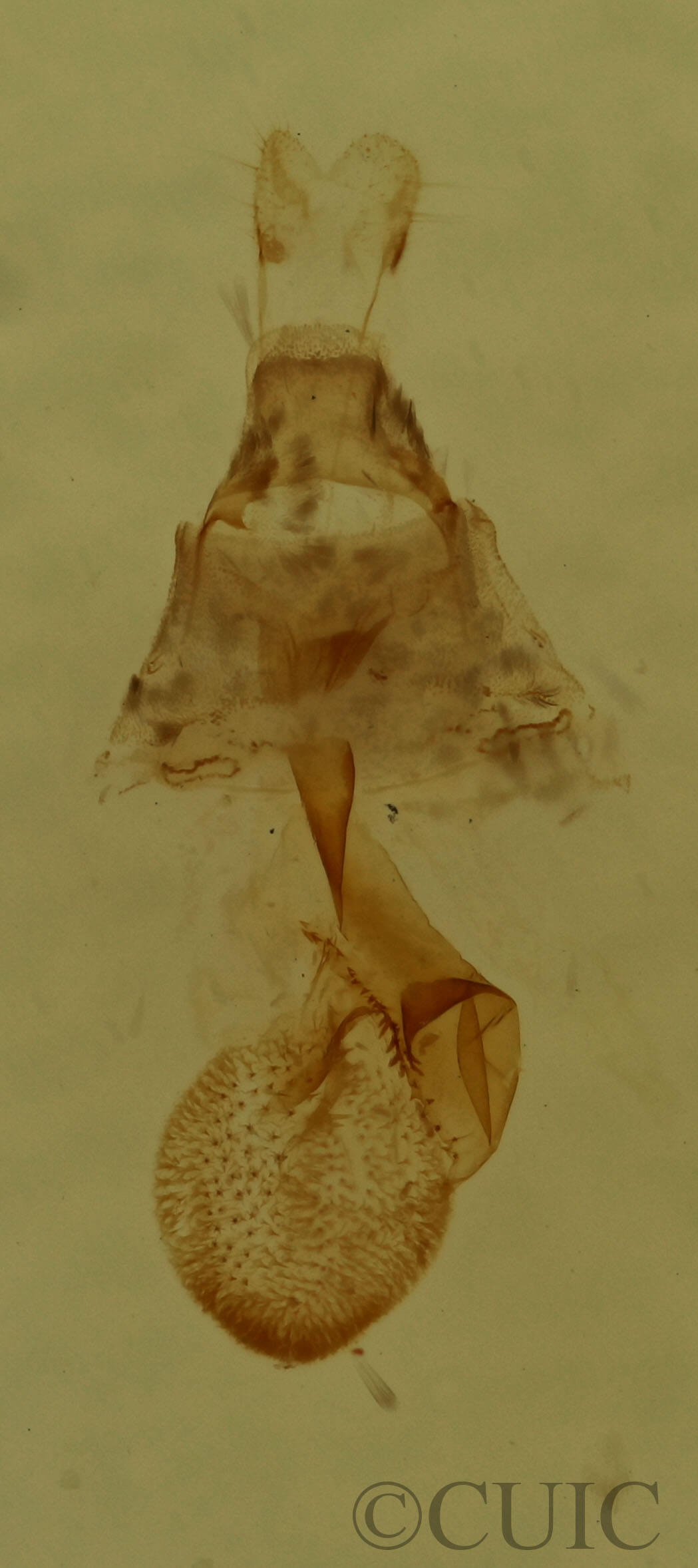 genitalia view of adult Eupithecia miserulata