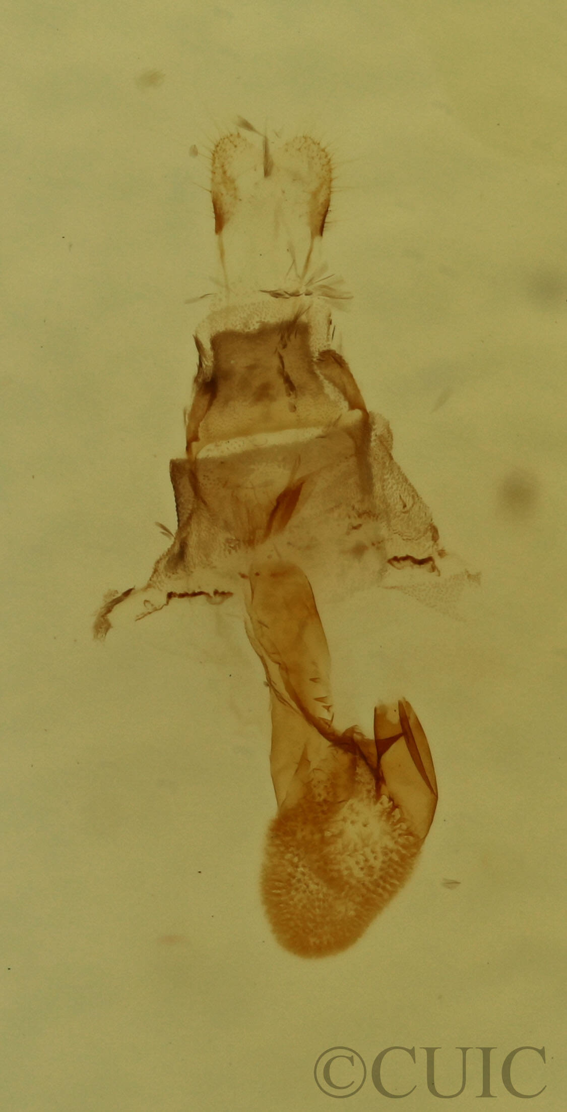 genitalia view of adult Eupithecia miserulata