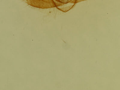 genitalia view of adult Exelis pyrolaria