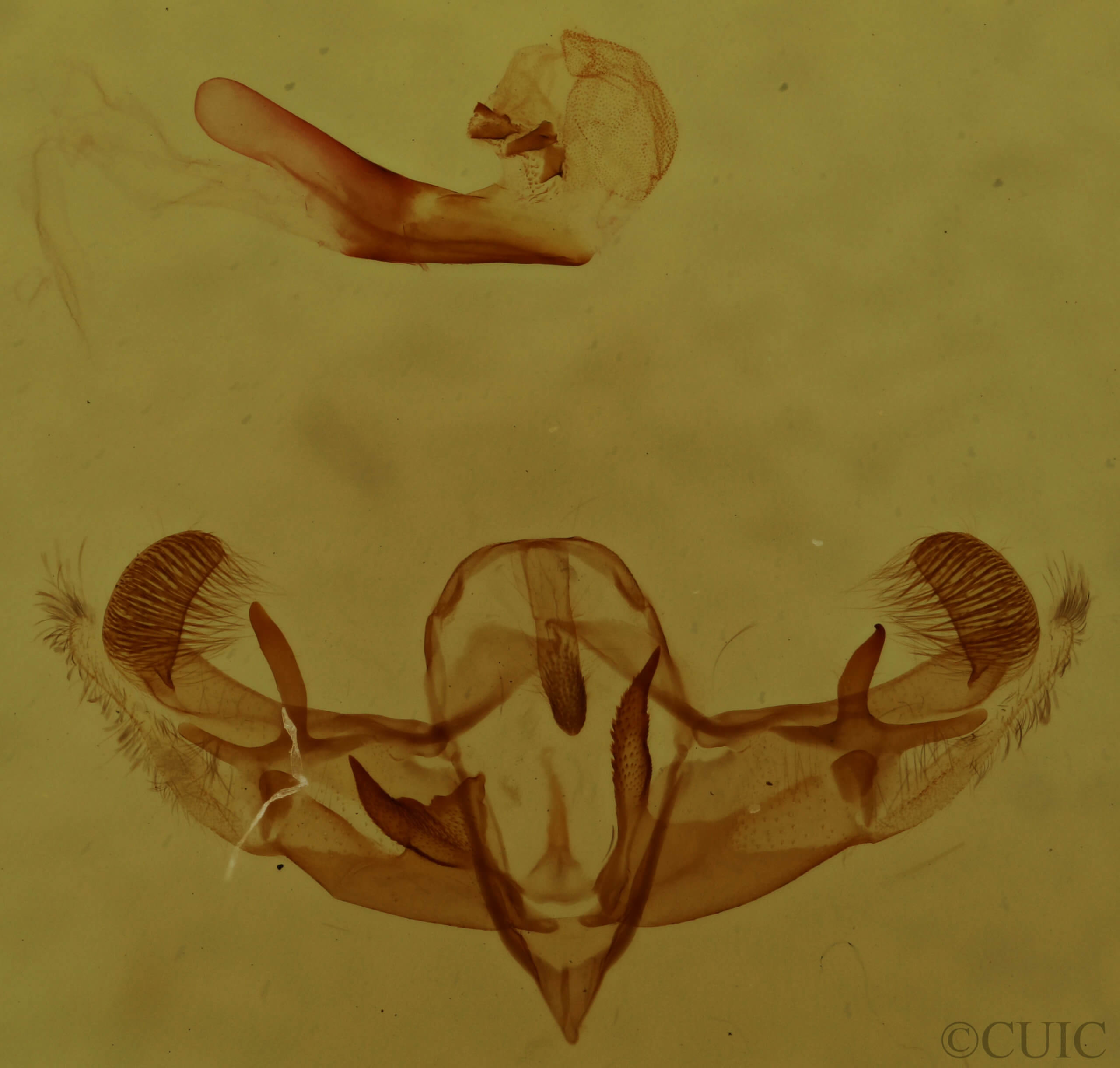 genitalia view of adult Galgula partita