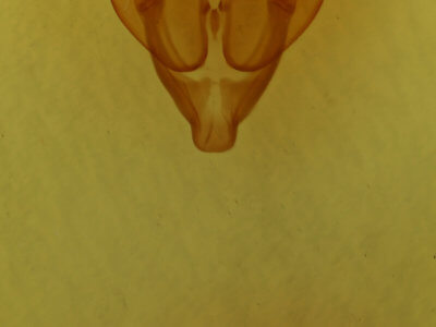 genitalia view of adult Hadena albimacula