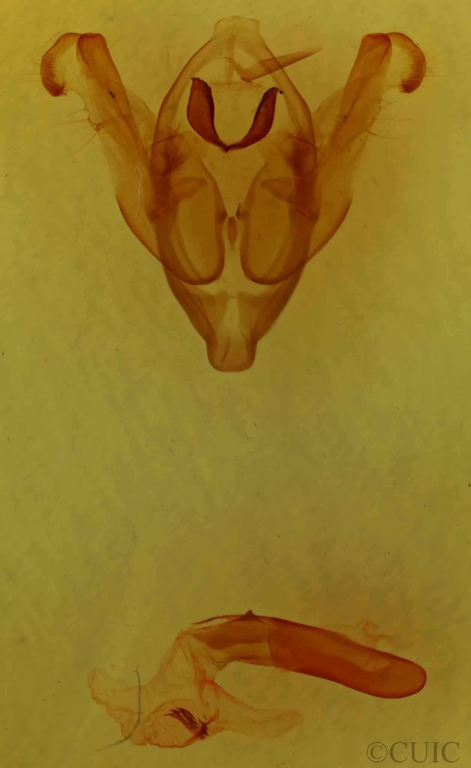 genitalia view of adult Hadena albimacula