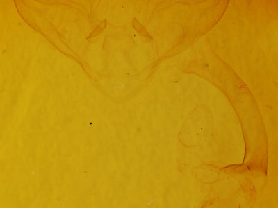 genitalia view of adult Halysidota tessellaris