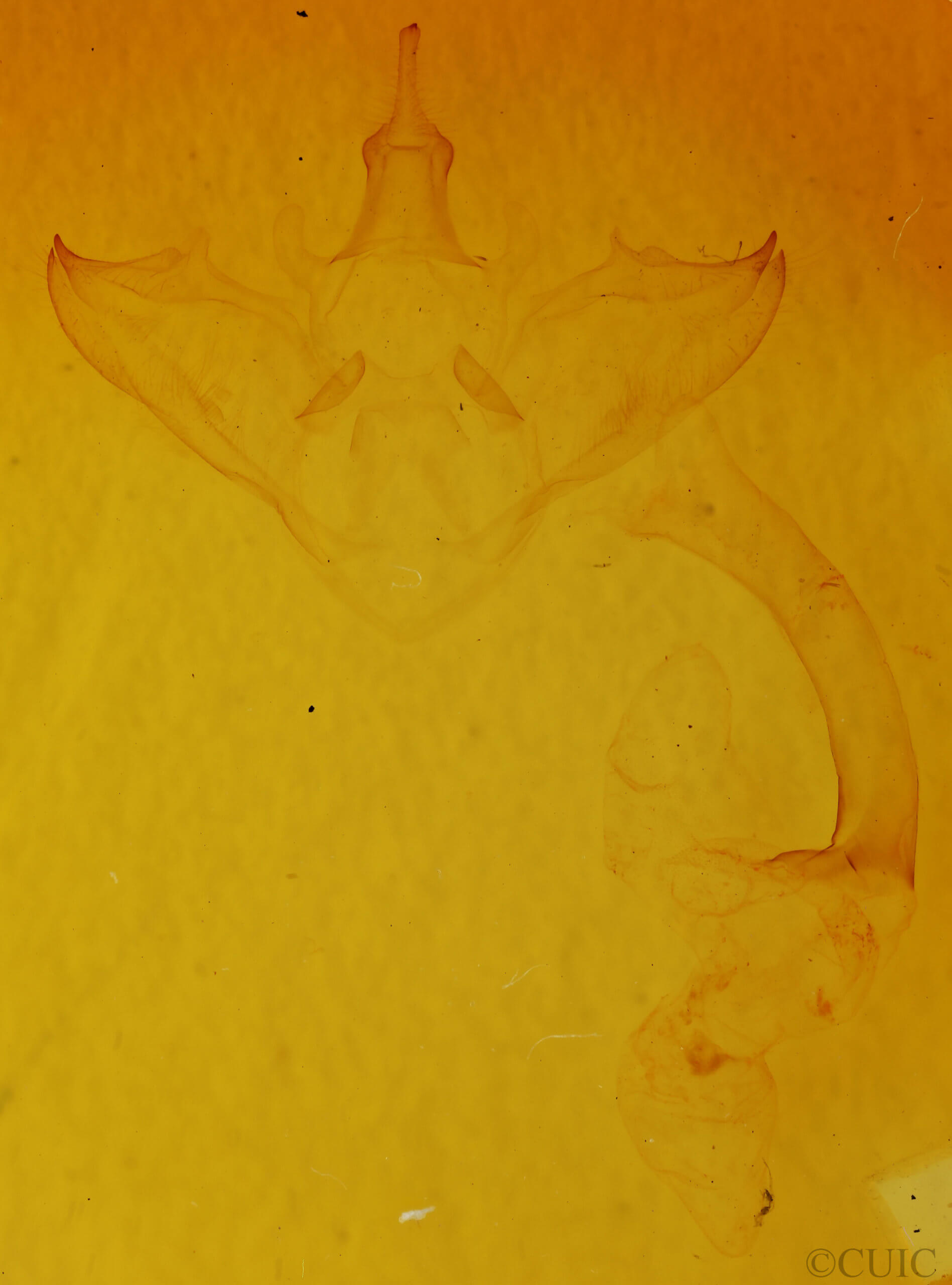 genitalia view of adult Halysidota tessellaris