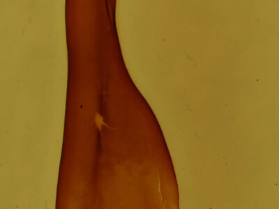 genitalia view of adult Rheumaptera prunivorata