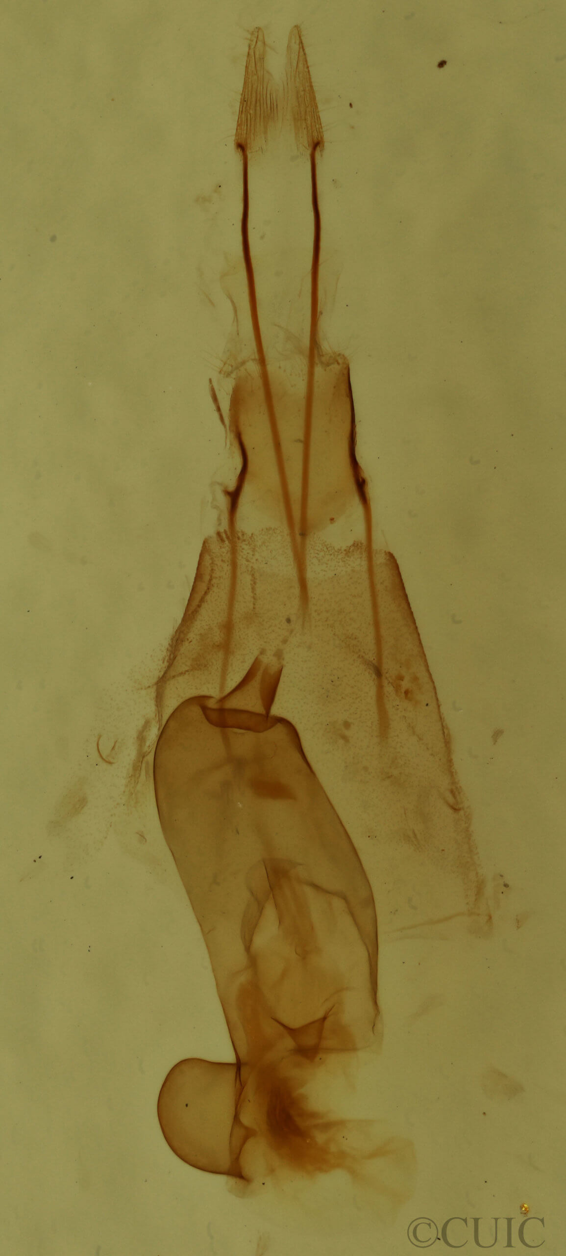 genitalia view of adult Hydriomena divisaria