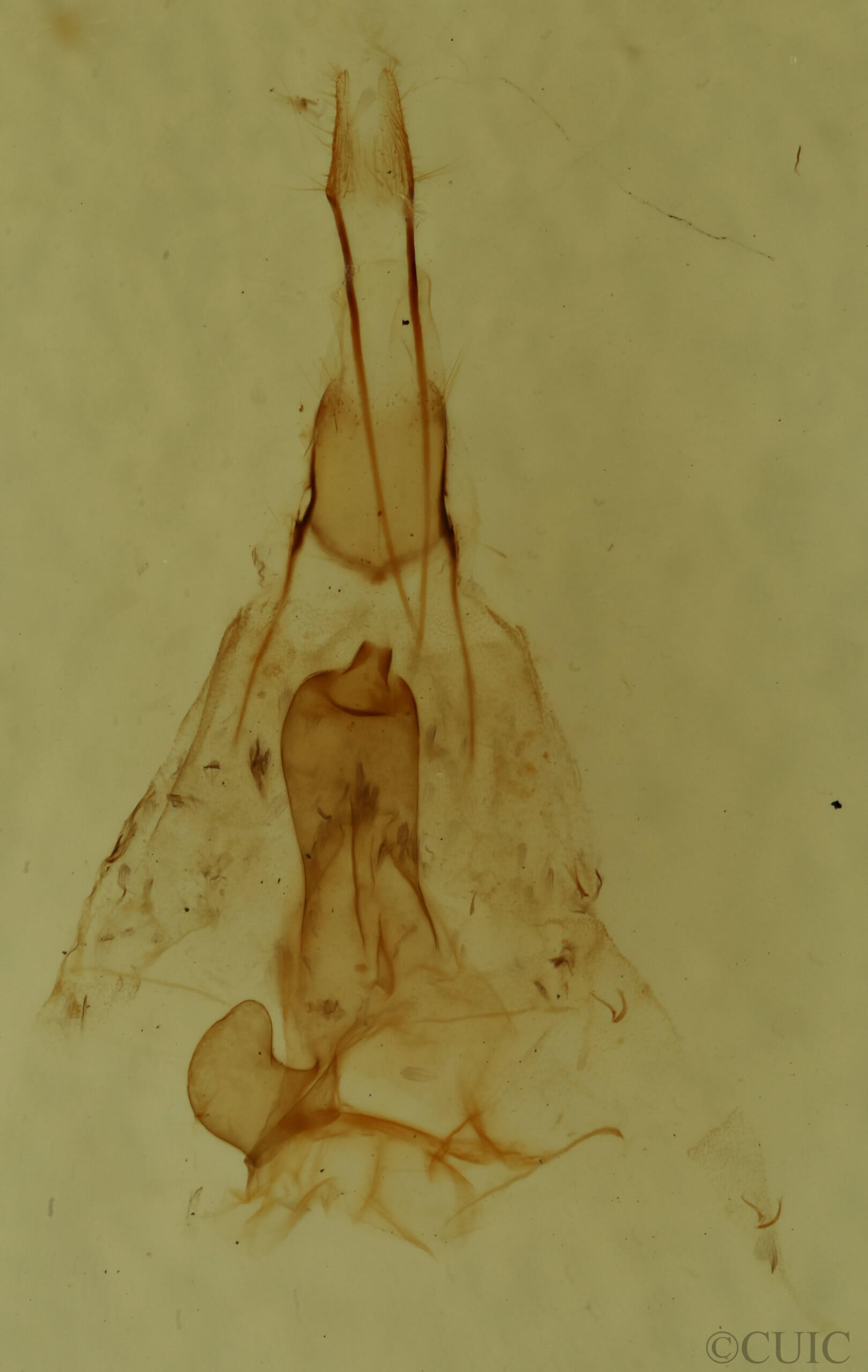 genitalia view of adult Hydriomena renunciata