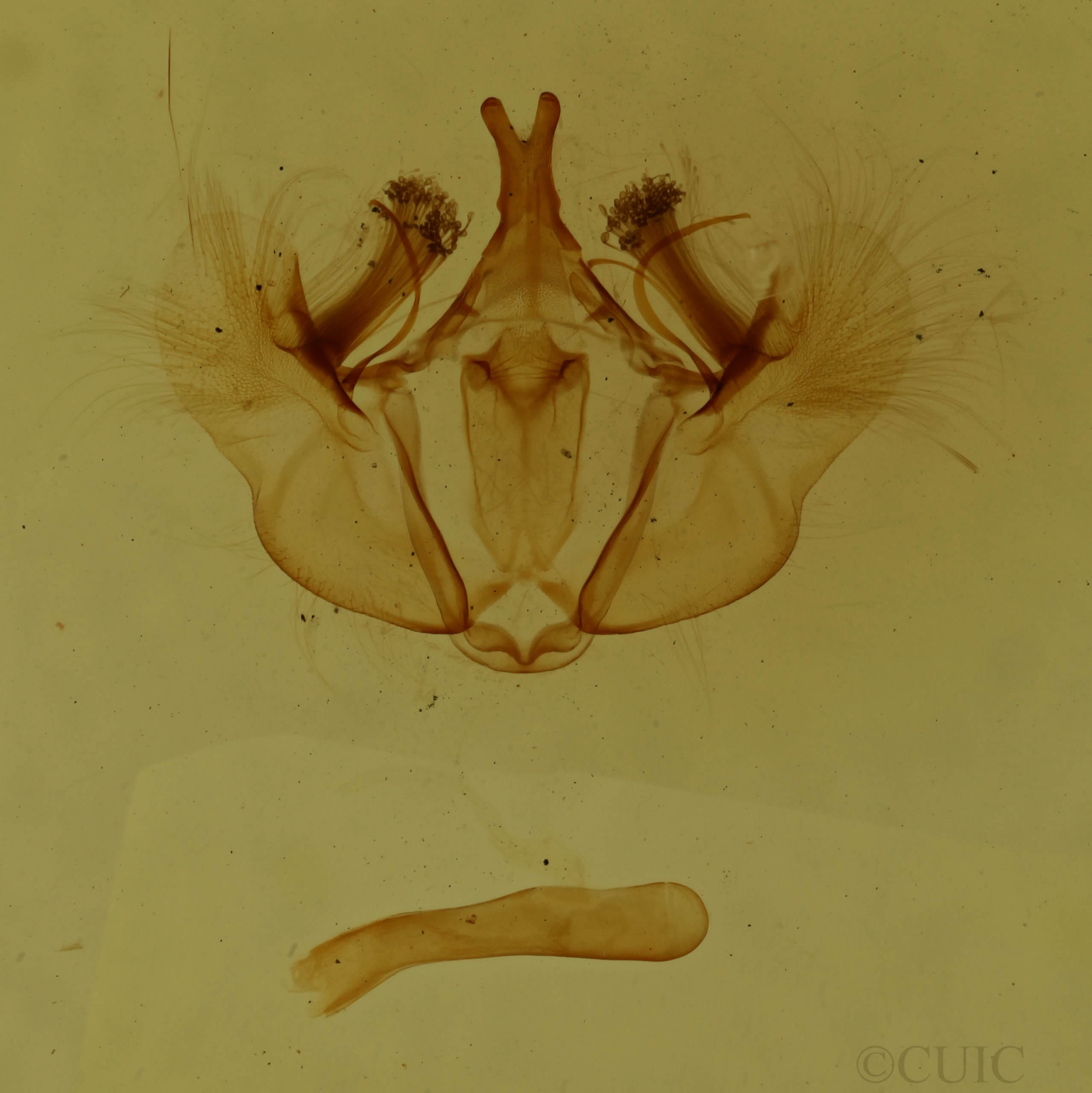 genitalia view of adult Hydriomena transfigurata manitoba