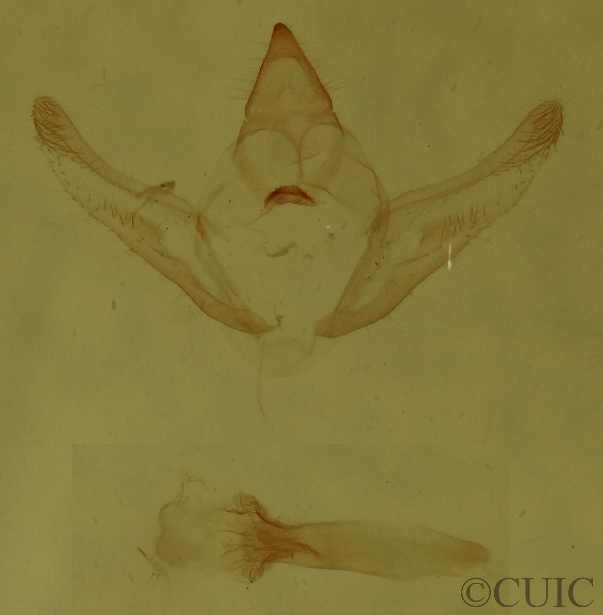 genitalia view of adult Hypagyrtis unipunctata