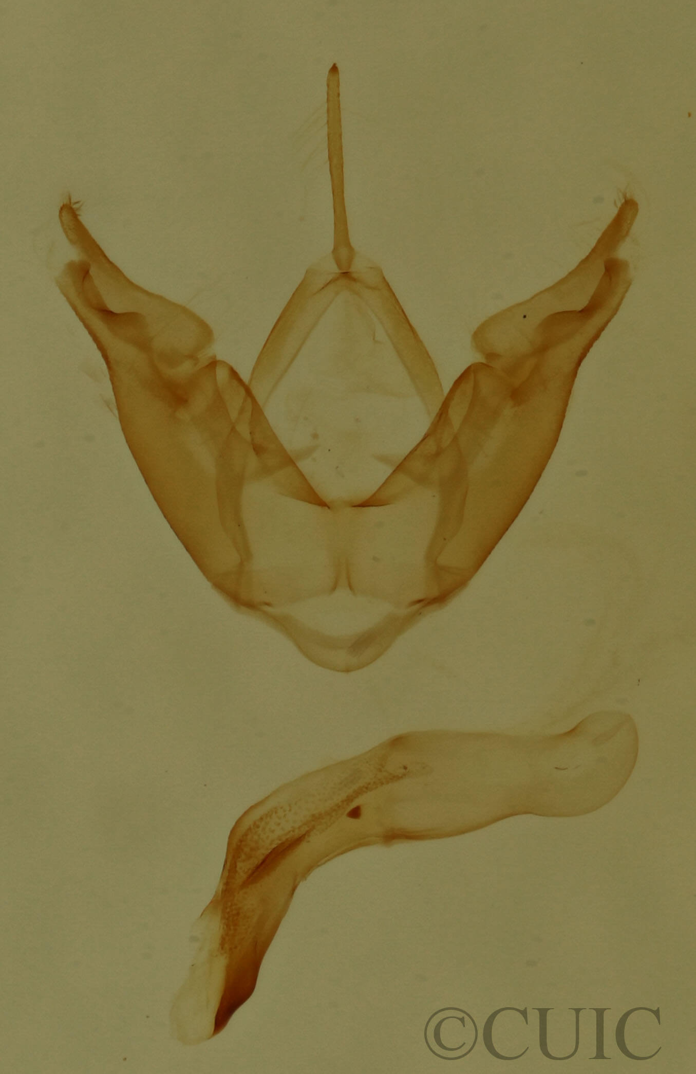 genitalia view of adult Hyperstrotia aetheria