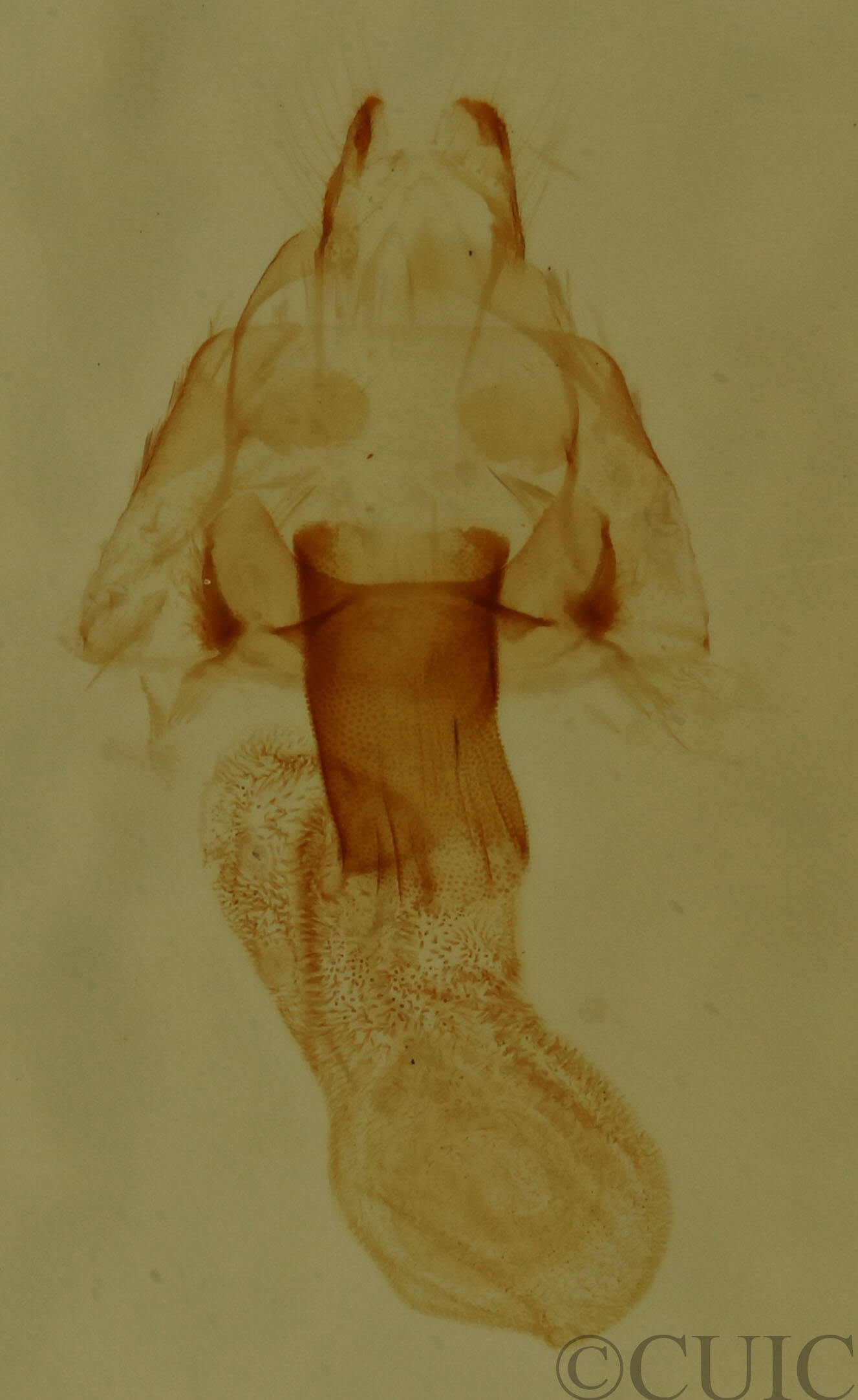 genitalia view of adult Hyperstrotia aetheria