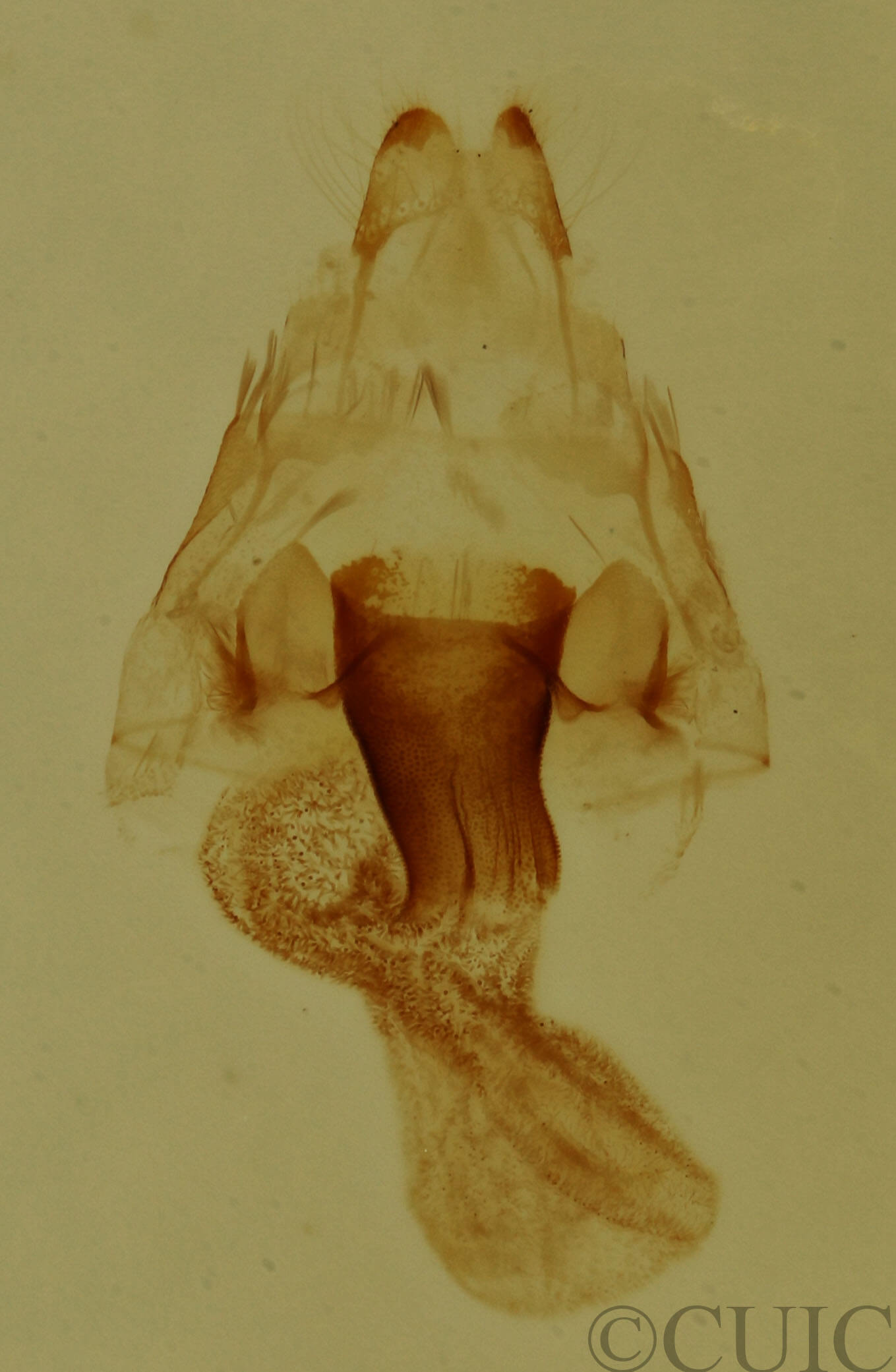 genitalia view of adult Hyperstrotia aetheria
