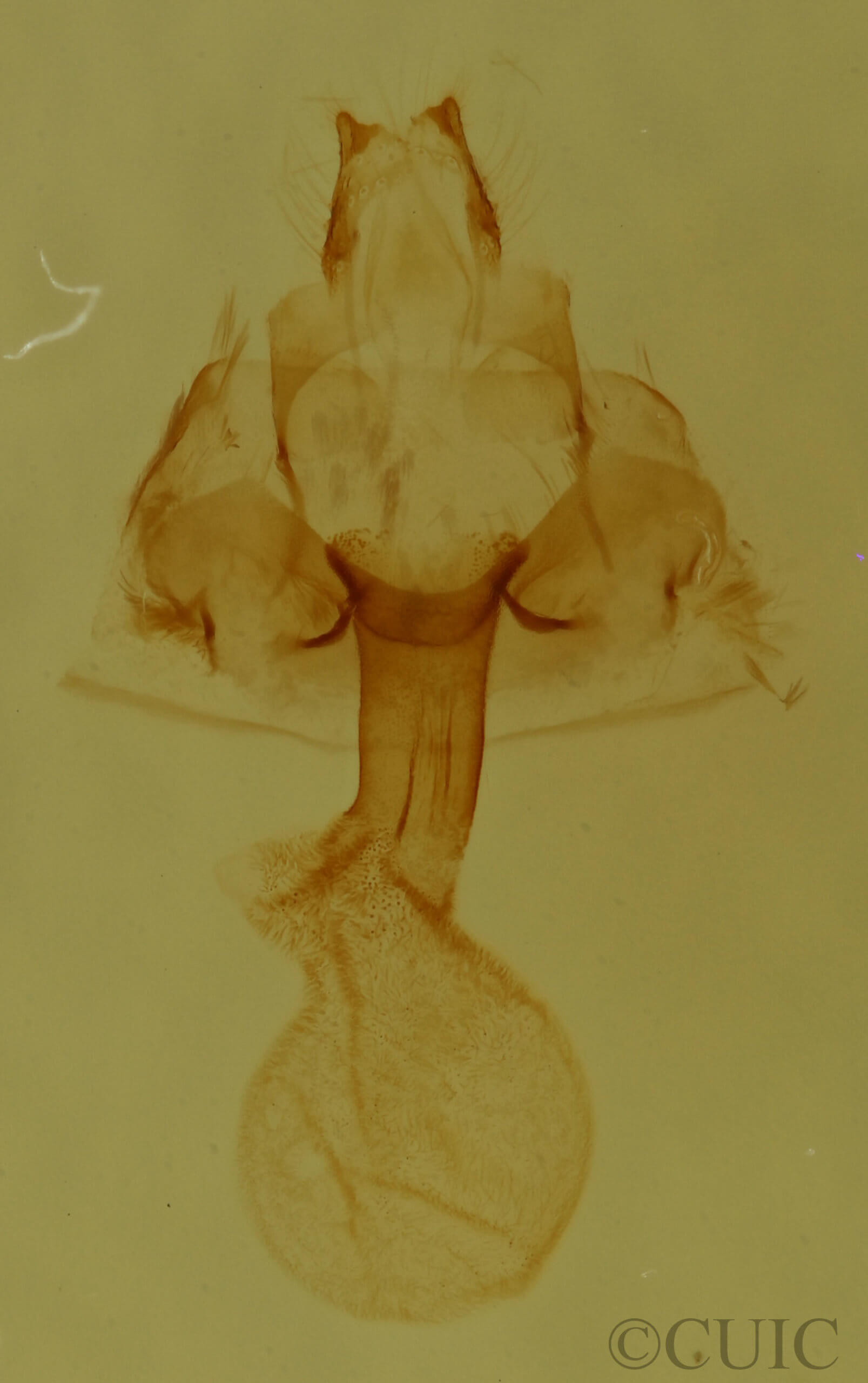 genitalia view of adult Hyperstrotia pervertens